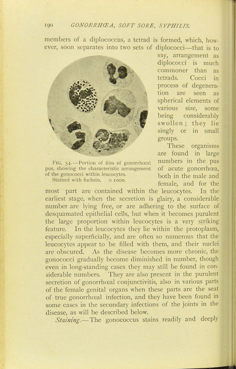 I members of a diplococcus, a tetrad is formed, which, how- ever, soon separates into two sets of diplococci—that is to say, arrangement as diplococci is much commoner than as tetrads. Cocci in process of degenera- tion are seen as spherical elements of various size, some being considerably swollen ; they lie singly or in small groups. These organisms are found in large numbers in the pus of acute gonorrhoea, both in the male and female, and for the most part are contained within the leucocytes. In the earliest stage, when the secretion is glairy, a considerable number are lying free, or are adhering to the surface of desquamated epithelial cells, but when it becomes purulent the large proportion within leucocytes is a very striking feature. In the leucocytes they lie within the protoplasm, especially superficially, and are often so numerous that the leucocytes appear to be filled with them, and their nuclei are obscured. As the disease becomes more chronic, the gonococci gradually become diminished in number, though even in long-standing cases they may still be found in con- siderable numbers. They are also present in the purulent secretion of gonorrhceal conjunctivitis, also in various parts of the female genital organs when these parts are the seat of true gonorrhceal infection, and they have been found in some cases in the secondary infections of the joints in the disease, as will be described below. Fig. 54.—Portion of film of gonorrhceal pus, showing the characteristic arrangement of the gonococci within leucocytes. Stained with fuchsin. x 1000. Staining.- -The gonococcus stains readily and deeply
