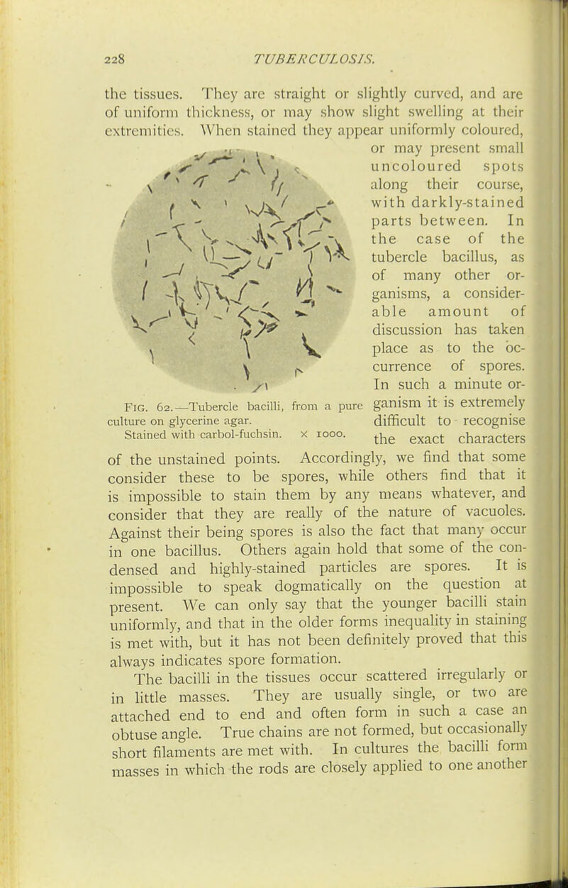 the tissues. They are straight or slightly curved, and are of uniform thickness, or may show slight swelling at their extremities. When stained they appear uniformly coloured, Fig. 62.—Tubercle bacilli, from a pure ganism it is extremely of the unstained points. Accordingly, we find that some consider these to be spores, while others find that it is impossible to stain them by any means whatever, and consider that they are really of the nature of vacuoles. Against their being spores is also the fact that many occur in one bacillus. Others again hold that some of the con- densed and highly-stained particles are spores. It is impossible to speak dogmatically on the question at present. We can only say that the younger bacilli stain uniformly, and that in the older forms inequality in staining is met with, but it has not been definitely proved that this always indicates spore formation. The bacilli in the tissues occur scattered irregularly or in little masses. They are usually single, or two are attached end to end and often form in such a case an obtuse angle. True chains are not formed, but occasionally short filaments are met with. In cultures the bacilli form masses in which the rods are closely applied to one another or may present small uncoloured spots along their course, with darkly-stained parts between. In the case of the tubercle bacillus, as of many other or- ganisms, a consider- able amount of discussion has taken place as to the oc- currence of spores. In such a minute or- culture on glycerine agar. Stained with carbol-fuchsin. x 1000. difficult to recognise the exact characters
