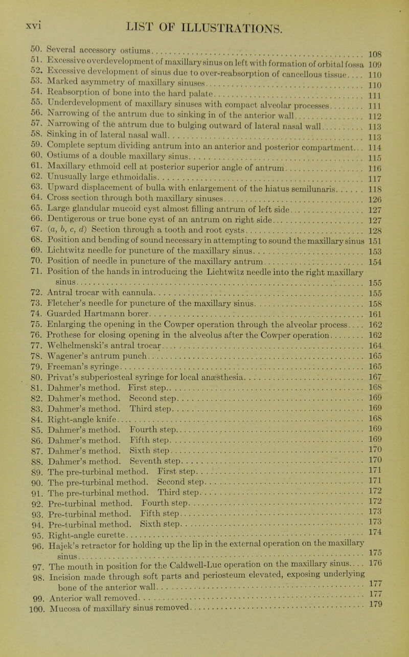 50. Several accessory ostiums jQg 51. Excessive overdovelopmont of maxillary sinus on left with formation of orbital fossa 109 52. Excessive development of sinus duo to over-reabsorption of cancellous ti.ssue.... 110 53. Marked asymmetry of maxillary sinuses HO 54. Reabsorption of bone into the hard palate HI 55. Underdevelopment of maxillary sinuses with compact alveolar processes Ill 56. NtuTowing of the antrum due to sinking in of the ant(!rior wall 112 57. Nai-rowing of the antrum due to bulging outward of lateral nasal wall.... . •. 113 58. Sinking in of lateral nasal wall 113 59. Complete septum dividing antrum into an anterior and posterior compartment... 114 60. Ostiums of a double maxillary sinus 115 61. Maxillary ethmoid cell at posterior superior angle of antrum 116 62. Unusually large ethmoidalis 117 63. Upward displacement of bulla with enlargement of the hiatus semilunaris 118 64. Cross section tlu-ough both maxillary sinuses 126 65. Large glandular mucoid cyst almost filling antrum of left side 127 66. Dentigerous or true bone cyst of an antrum on right side 127 67. (a, b, c, d) Section through a tooth and root cysts 128 68. Position and bending of sound necessary in attempting to sound the maxillary sinus 151 69. Lichtwitz needle for puncture of the maxillary sinus 153 70. Position of needle in puncture of the maxillary antrum 154 71. Position of the hands in introducing the Lichtwitz needle into the right maxillary sinus • 155 72. Antral trocar with cannula 155 73. Fletcher's needle for puncture of the maxillary sinus 158 74. Guarded Hartmann borer 161 75. Enlarging the opening in the Cowper operation through the alveolar process.. .. 162 76. Prothese for closing opening in the alveolus after the Cowper operation 162 77. Welhelmenski's antral trocar 164 78. Wagener's antrum punch 165 79. Freeman's syringe 165 80. Privat's subperiosteal syringe for local anaesthesia 167 81. Dahmer's method. First step 168 82. Dahmer's method. Second step 169 83. Dahmer's method. Third step 169 84. Right-angle knife 168 85. Dahmer's method. Fourth step , 169 86. Dahmer's method. Fifth step 169 87. Dahmer's method. Sixth step 170 88. Dahmer's method. Seventh step 170 89. The pre-turbinal method. First step 171 90. The pre-turbinal method. Second step 171 91. The pre-turbinal method. Third step 172 92. Pre-turbinal method. Fourth step 172 93. Pre-tm-binal method. Fifth step 173 94. Pre-turbinal method. Sixth step Ip 95. Right-angle curette • 174 96. Hajek's retractor for holding up the lip in the external operation on the maxillary sinus ^'^ 97. The mouth in position for the Caldwcll-Luc operation on the maxillary sinus.... 176 98. Incision made through soft parts and periosteum elevated, exposing underiying bone of the anterior wall -^^^ 99. Anterior wall removed ^ 100. Mucosa of maxillary sinus removed