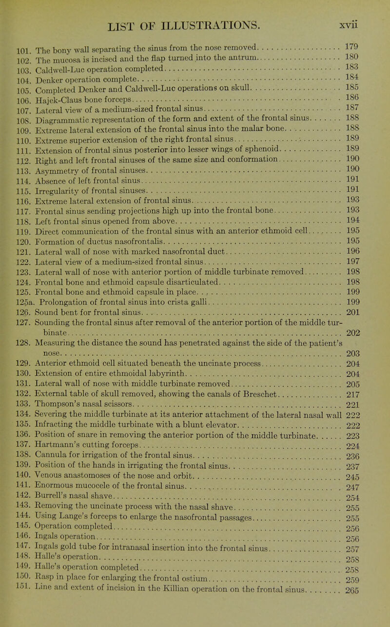 101. The bony wall separating the sinus from the nose removed 179 102. The mucosa is incised and the flap turned into the antrum 180 103. Caldwell-Luc operation completed 183 104. Danker operation complete 184 105. Completed Denker and Caldwell-Luc operations on skull 185 106. Hajek-Claus bone forceps 186 107. Lateral view of a medium-sized frontal sinus 187 108. Diagrammatic representation of the form and extent of the frontal sinus 188 109. Extreme lateral extension of the frontal sinus into the malar bone 188 110. Extreme superior extension of the right frontal sinus 189 111. Extension of frontal sinus posterior into lesser wings of sphenoid 189 112. Right and left frontal sinuses of the same size and conformation 190 113. Asymmetry of frontal sinuses 190 114. Absence of left frontal sinus 191 115. Irregularity of frontal sinuses 191 116. Extreme lateral extension of frontal sinus 193 117. Frontal sinus sending projections high up into the frontal bone 193 118. Left frontal sinus opened from above 194 119. Direct communication of the frontal sinus with an anterior ethmoid cell 195 120. Formation of ductus nasofrontahs 195 121. Lateral wall of nose with marked nasofrontal duct 196 122. Lateral view of a medium-sized frontal sinus 197 123. Lateral wall of nose with anterior portion of middle turbinate removed 198 124. Frontal bone and ethmoid capsule disarticulated 198 125. Frontal bone and ethmoid capsule in place 199 125a. Prolongation of frontal sinus into crista galli 199 126. Sound bent for frontal sinus 201 127. Sounding the frontal sinus after removal of the anterior portion of the middle tur- binate 202 128. Measuring the distance the sound has penetrated against the side of the patient's nose 203 129. Anterior ethmoid cell situated beneath the uncinate process 204 130. Extension of entire ethmoidal labyrinth 204 131. Lateral wall of nose with middle turbinate removed 205 132. External table of skull removed, showing the canals of Breschet 217 133. Thompson's nasal scissors 221 134. Severing the middle turbinate at its anterior attachment of the lateral nasal wall 222 135. Infracting the middle turbinate with a blvmt elevator 222 136. Position of snare in removing the anterior portion of the middle turbinate 223 137. Hartmann's cutting forceps 224 138. Cannula for irrigation of the frontal sinus 236 139. Position of the hands in irrigating the frontal sinus 237 140. Venous anastomoses of the nose and orbit 245 141. Enormous mucocele of the frontal sinus 247 142. Burrell's nasal shave 254 143. Removing the uncinate process with the nasal shave 255 144. Using Lange's forceps to enlarge the nasofrontal passages 255 145. Operation completed 256 146. Ingals operation 256 147. Ingals gold tube for intranasal insertion into the frontal sinus 257 148. Halle's operation 258 149. Halle's operation completed 258 150. Rasp in place for enlarging the frontal ostium 259 151. Line and extent of incision in the Killian operation on the frontal sinus 265