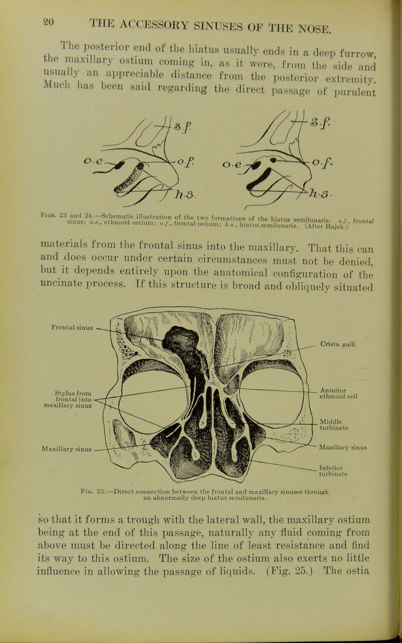 The posterior end of the liiatus usually ends in a deep furrow the maxillary ostium coming in, as it were, from the side and usually an appreciable distance from the posterior extremity. Much has been said regarding the direct passage of purulent oe r materials from the frontal sinus into the maxillary. That this can and does occur under certain circumstances must not be denied, but it depends entirely upon the anatomical configuration of the uncinate process. If this structure is broad and obliquely situated Frontal sinus Stylus from frontal into maxillary sinus Maxillary sinus Crista galli Anterior ethmoid cell Middle turbinate Maxillary sinus Inferior turbinate Fig. 2o.—Direct connection between the frontal and maxillary sinuses through an abnormally deep hiatus semilunaris. SO that it forms a trough with the lateral wall, the maxillary ostium being at the end of this passage, naturally any fluid coming from above must be directed along the line of least resistance and find its way to this ostium. The size of the ostium also exerts no little influence in allowing the passage of liquids. (Fig. 25.) The ostia