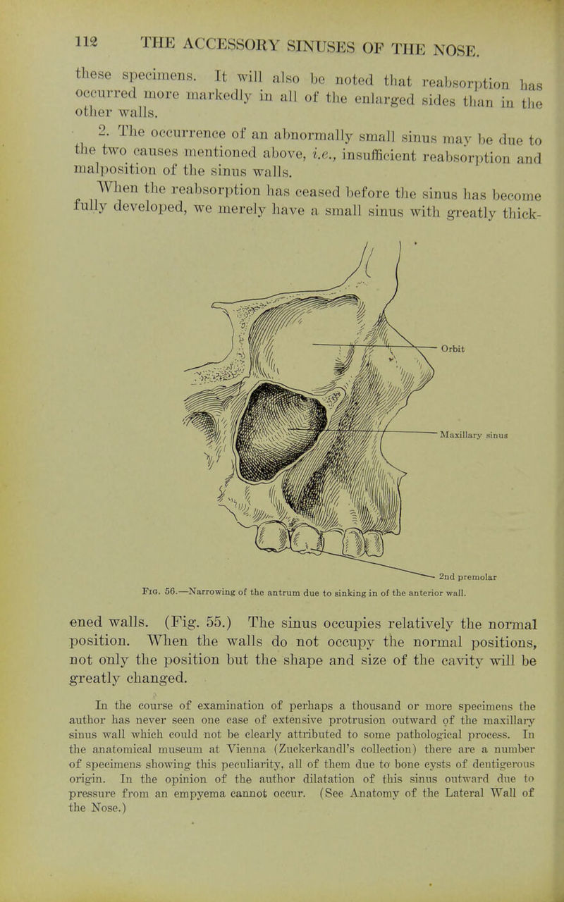 these specimens. It will also be noted that reabsorption has occurred more markedly in all of the enlarged sides than in the other walls. 2. The occurrence of an abnormally small sinus may be due to the two causes mentioned above, i.e., insufficient reabsorption and malposition of the sinus walls. When the reabsorption has ceased before the sinus has become fully developed, we merely have a small sinus with greatly thick- Orbit Maxillary sinus 2nd premolar Fig. 56.—Narrowing of the antrum due to sinking in of the anterior wall. ened walls. (Fig. 55.) The sinus occupies relatively the normal position. When the walls do not occupy the normal positions, not only the position but the shape and size of the cavity will be greatly changed. In the course of examination of perhaps a thousand or more specimens the author has never seen one ease of extensive protrusion outward of the maxillary- sinus wall which could not be clearly attributed to some pathological process. In the anatomical museum at Vienna (ZuckerkandPs collection) thei'e are a number of specimens showing this peculiarity, all of them due to bone cysts of dentigerous origin. In the opinion of the author dilatation of this sinus outward due to pressure from an empyema cannot occur. (See Anatomy of the Lateral Wall of the Nose.)