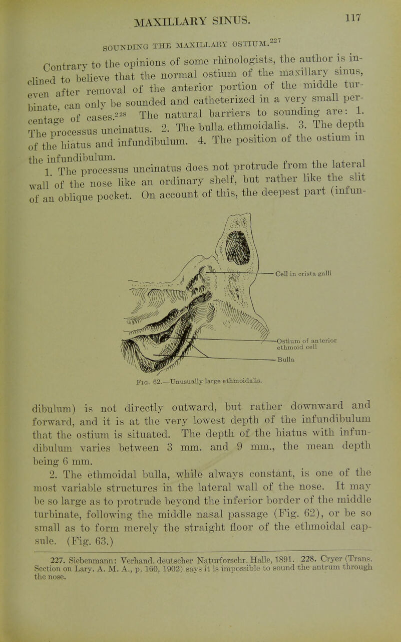 007 SOUNDING THE MAXILLARY OSTIUM.-^ nnntrarv to the opinions of some rliinologists, the author is in- T.^rto believe that the normal ostium of the maxillary smus, fv'n af er 1^^^^^^^^^ of the anterior portion of the middle tur- 1 Jn^^te can only be sounded and catheterized m a very small per- T ' nf pasesThe natural barriers to sounding are: 1. ^utp^eLr^neinatus. 2. The bulla ethmoidalis. 3. The depth of the hiatus and infundibulum. 4. The position of the ostium m the infuudibulmn. ^ 1 The processus uncinatus does not protrude from the lateral wall* of the nose like an ordinary shelf, but rather like the slit of an obUque pocket. On account of this, the deepest part (mfun- Cell in crista galli Ostium of anterior ethmoid cell Bulla jPiQ. 62.—Unusually large ethmoidalis. dibulum) is not directly outward, but rather downward and forward, and it is at the very lowest depth of the infundibulum that the ostium is situated. The depth of the hiatus with infun- dibulum varies between 3 mm. and 9 mm., the mean depth being 6 mm. 2. The ethmoidal bulla, while always constant, is one of the most variable structures in the lateral wall of the nose. It may be so large as to protrude beyond the inferior border of the middle turbinate, following the middle nasal passage (Fig. 62), or be so small as to form merely the straight floor of the ethmoidal cap- sule. (Fig. 63.) 227. Siebenmann: Verhand. deutscher Naturforschr. Halle, 1891. 228. Cryer (Trans. Section on Lary. A. M. A., p. 160, 1902) says it is impossible to sound the antrum through the nose.