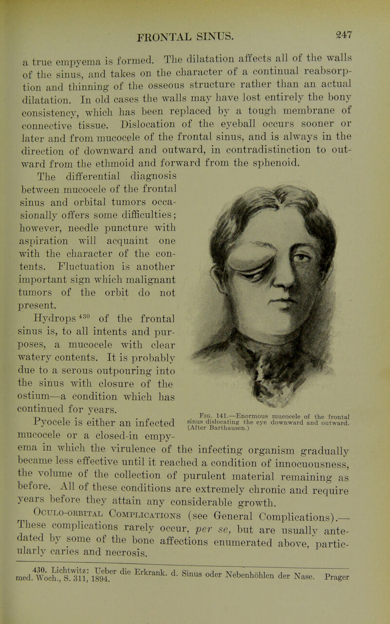 a true empyema is formed. The dilatation affects all of the walla of tlie sinus, and takes on the character of a continual reabsorp- tion and thinning of the osseous structure rather than an actual dilatation. In old cases the walls may have lost entirely the bony consistency, which has been replaced by a tough membrane of connective tissue. Dislocation of the eyeball occurs sooner or later and from mucocele of the frontal sinus, and is always in the direction of downward and outward, in contradistinction to out- ward from the ethmoid and forward from the sphenoid. The differential diagnosis between mucocele of the frontal sinus and orbital tumors occa- sionally offers some difficulties; however, needle jDuncture with aspiration will acquaint one with the character of the con- tents. Fluctuation is another important sign which malignant tumors of the orbit do not present. Hydrops of the frontal sinus is, to all intents and pur- poses, a mucocele with clear watery contents. It is probably due to a serous outpouring into the sinus with closure of the ostium—a condition which has continued for years. Pyocele is either an infected mucocele or a closed-in empy- ema in which the virulence of the infecting organism gradually became less effective until it reached a condition of innocuousness, the volume of the collection of purulent material remaining as before. All of these conditions are extremely chronic and require years before they attain any considerable growth. OcuLo-oKBiTAL COMPLICATIONS (sec General Complications) — These complications rarely occur, per se, but are usually ante- dated by some of the bone affections enumerated above, partic- ularly caries and necrosis. Fig. 141.—Enormou.s mucocele of the frontal sinu.s dislocating the eye downward and outward. (After Barthausen.) med. mchll'tn; ^^^ Nebenhohlen der Nase. Prager