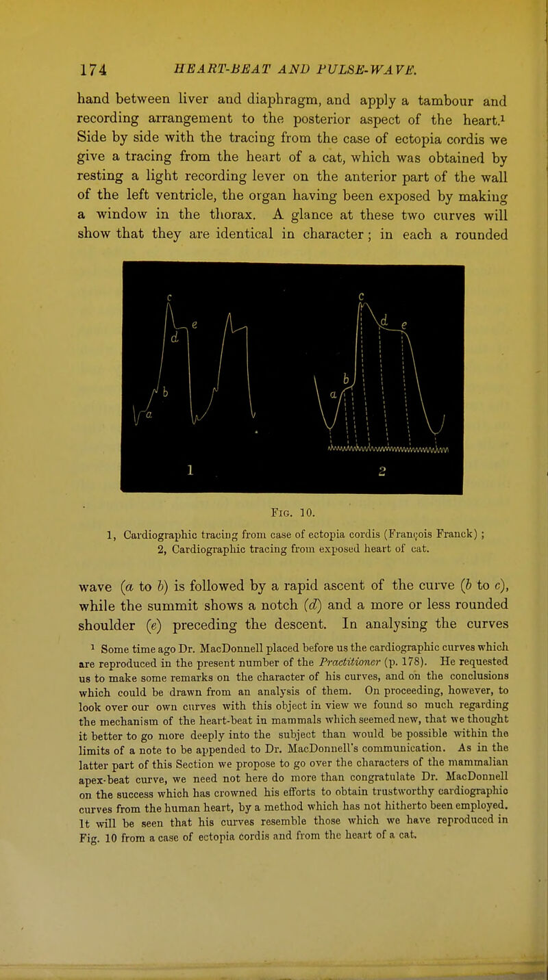 hand between liver and diaphragm, and apply a tambour and recording arrangement to the posterior aspect of the heart.1 Side by side with the tracing from the case of ectopia cordis we give a tracing from the heart of a cat, which was obtained by resting a light recording lever on the anterior part of the wall of the left ventricle, the organ having been exposed by making a window in the thorax. A glance at these two curves will show that they are identical in character; in each a rounded Fig. 10. 1, Cardiography tracing front case of ectopia cordis (Francois Franck); 2, Cardiography tracing from exposed heart of cat. wave (a to b) is followed by a rapid ascent of the curve (b to c), while the summit shows a notch (d) and a more or less rounded shoulder (e) preceding the descent. Ia analysing the curves 1 Some time ago Dr. MacDonnell placed before us the cardiographic curves which are reproduced in the present number of the Practitioner (p. 178). He requested us to make some remarks on the character of his curves, and on the conclusions which could be drawn from an analysis of them. On proceeding, however, to look over our own curves with this object in view we found so much regarding the mechanism of the heart-beat in mammals which seemed new, that we thought it better to go more deeply into the subject than would be possible within the limits of a note to be appended to Dr. MacDonnell's communication. As in the latter part of this Section we propose to go over the characters of the mammalian apex-beat curve, we need not here do more than congratulate Dr. MacDonnell on the success which has crowned his efforts to obtain trustworthy cardiography curves from the human heart, by a method which has not hitherto been employed. It will be seen that his curves resemble those which we have reproduced in Fig. 10 from a case of ectopia cordis and from the heart of a cat.