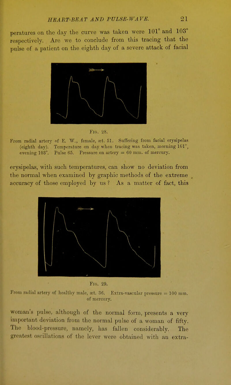 peratures on the clay the curve was taken were 101° and 103° respectively. Are, we to conclude from this tracing that the pulse of a patient on the eighth day of a severe attack of facial Fig. 28. From radial artery of E. W., female, set. 51. Suffering from facial erysipelas (eighth day). Temperature on day when tracing was taken, morning 101°, evening 103°. Pulse 65. Pressure on artery = 60 mm. of mercury. erysipelas, with such temperatures, can show no deviation from the normal when examined by graphic methods of the extreme accuracy of those employed by us ? As a matter of fact, this Fig. 29. oin radial artery of healthy male, ajt. 36. Extra-vascular pressure = 100 mm. of mercury. woman's pulse, although of the normal form, presents a very- important deviation from the normal pulse of a woman of fifty. The blood-pressure, namely, has fallen considerably. The greatest oscillations of the lever were obtained with an extra-