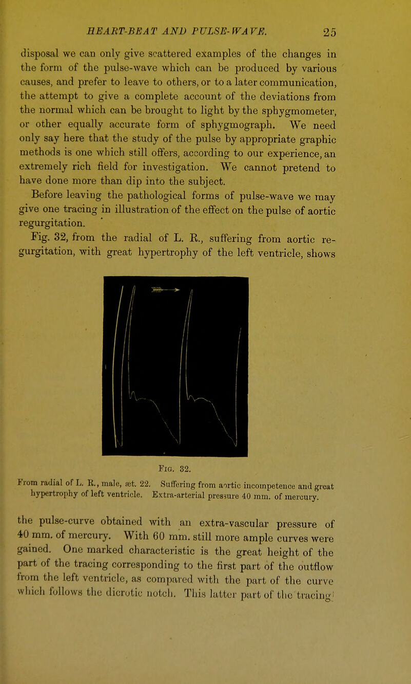 disposal we can only give scattered examples of the changes in the form of the pulse-wave which can he produced by various causes, and prefer to leave to others, or to a later communication, the attempt to give a complete account of the deviations from the normal which can be brought to light by the sphygmometer, or other equally accurate form of sphygmograph. We need only say here that the study of the pulse by appropriate graphic methods is one which still offers, according to our experience, an extremely rich field for investigation. We cannot pretend to have done more than dip into the subject. Before leaving the pathological forms of pulse-wave we may give one tracing in illustration of the effect on the pulse of aortic regurgitation. Fig. 32, from the radial of L. R, suffering from aortic re- gurgitation, with great hypertrophy of the left ventricle, shows Fig. 32. From radial of L. K., male, .net. 22. Suffering from aortic incompetence and great hypertrophy of left ventricle. Extra-arterial pressure 40 mm. of mercury. the pulse-curve obtained with an extra-vascular pressure of 40 mm. of mercury. With 60 mm. still more ample curves were gained. One marked characteristic is the great height of the part of the tracing corresponding to the first part of the outflow from the left ventricle, as compared with the part of the curve which follows the dicrotic notch. This latter part of the tracing}