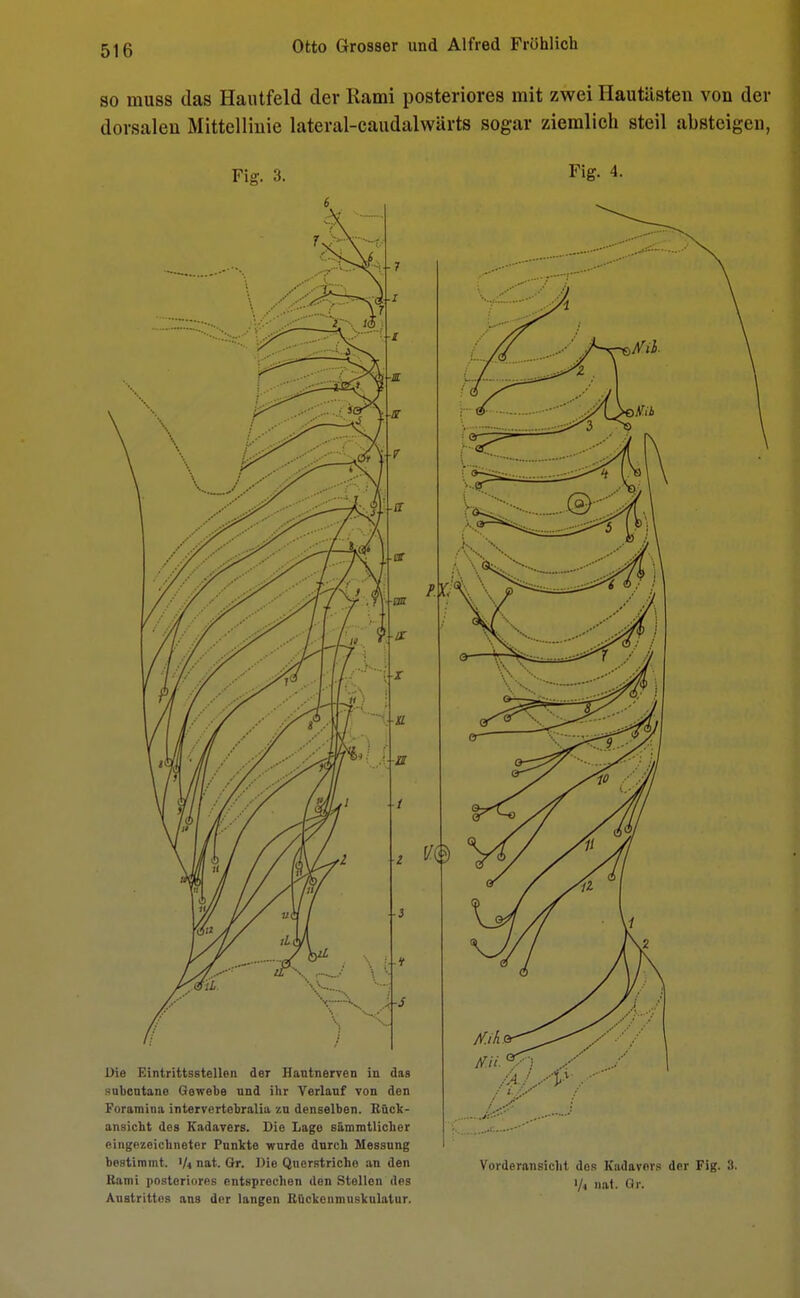 so muss das Hantfeld der Rami posteriores mit zwei Hautiisten von der dorsalen Mittellinie lateral-caudalwärts sogar ziemlich steil absteigen, Fig. 3. Fig- 4- ansieht des Kadavers. Die Lage sämmtlicher eingezeichneter Punkte wnrde dnreh Messung bestimmt, •/< nat. Gr. Wie Querstriche an den Vorderansicht dos Kadavers der Fig. 3. Rami posteriores entsprechen den Stellen des \jt llaf_ Qr, Austrittes ans der langen ßückenmuskulatur.