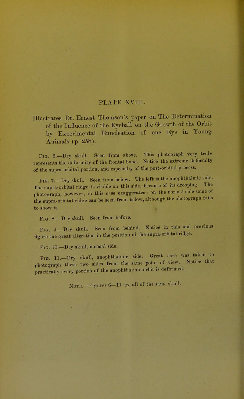 PLATE XVIII. Illustrates Dr. Ernest Thomson's paper on The Determination of the Influence of the Eyeball on the Gkowth of the Orbit by Experimental Enucleation of one Eye in Toung Animals (p. 258). Fig. 6.—Dry skull. Seen from above. This photograph very truly represents the deformity of the frontal bone. Notice the extreme deformity of the supra-orbital portion, and especially of the post-orbital process. Fig. 7.—Dry skull. Seen from below. The left is the anophthalmic side. The supra-orbital ridge is visible on this side, because of its drooping. The photograph, however, in this case exaggerates : on the normal side some of the supra-orbital ridge can be seen from below, although the photograph fails to show it. Fig. 8.—Dry skull. Seen from before. Fig. 9.—Dry skull. Seen from behind. Notice in this and previous figure the great alteration in the position of the supra-orbital ridge. Fig. 10.—Dry skull, normal side. Fig 11—Dry skull, anophthalmic side. Great care was taken to pbotograph these two sides from the same point of view. Notice that practically every portion of the anophthalmic orbit is deformed. Xote— Figures 6—11 are all of the same skull.