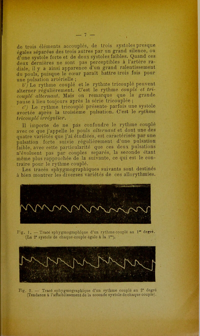 de trois éléments accouplés, de trois systoles presque égales séparées des trois autres par un grand silence, ou d'une systole forte et de deux systoles faibles. Quand ces deux dernières ne sont pas perceptibles à l'artère ra- diale, il y a ainsi apparence d'un grand ralentissement du pouls, puisque le cœur paraît battre trois fois pour une pulsation artérielle ; &') Le rythme couplé et le rythme tricouplé peuvent alterner régulièrement. C'est le rythme couplé et tri- couplé alternant. Mais on remarque que la grande pause à lieu toujours après la série tricouplée ; c') Le rythme tricouplé présente parfois une systole avortée après la troisième pulsation. C'est le rythme tricouplé irrégulier. Il importe de ne pas confondre le rythme couplé avec ce que j'appelle le pouls alternant et dont une des quatre variétés que j'ai étudiées, est caractérisée par une pulsation forte suivie régulièrement d'une pulsation faible, avec cette particularité que ces deux pulsations n'évoluent pas par couples séparés, la seconde étant même plus rapprochée de la suivante, ce qui est le con- traire pour le rythme couplé. Les tracés sphygmographiques suivants sont destinés à bien montrer les diverses variétés de ces allorythmies. F-'g. I, —■ Tracé sphygmographique d'un rythme couplé au 1** degré. (La 2* systole de chaque-couple égale à la 1). Fig. 2. — Tracé sphygmographique d'un rythme couplé au 2* degré (Tendance à l'affaiblissement de la seconde systole de chaque couple).