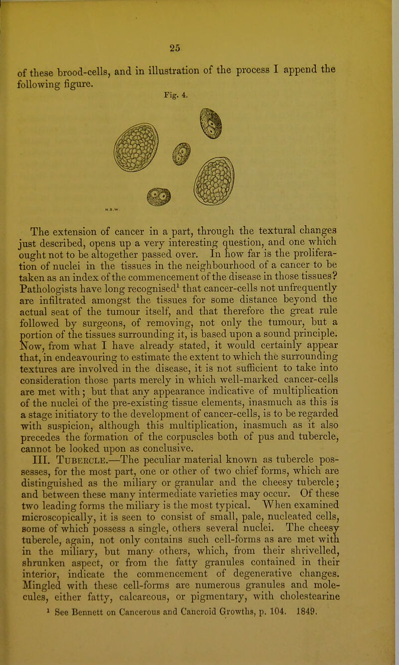 of these brood-cells, and in illustration of the process I append the following figure. The extension of cancer in a part, through the textural changes just described, opens up a very interesting question, and one which ought not to be altogether passed over. In how far is the prolifera- tion of nuclei in the tissues in the neighbourhood of a cancer to be taken as an index of the commencement of the disease in those tissues? Pathologists have long recognised1 that cancer-cells not unfrequently are infiltrated amongst the tissues for some distance beyond the actual seat of the tumour itself, and that therefore the great rule followed by surgeons, of removing, not only the tumour, but a portion of the tissues surrounding it, is based upon a sound principle. Now, from what I have already stated, it would certainly appear that, in endeavouring to estimate the extent to which the surrounding textures are involved in the disease, it is not sufficient to take into consideration those parts merely in which well-marked cancer-cells are met with; but that any appearance indicative of multiplication of the nuclei of the pre-existing tissue elements, inasmuch as this is a stage initiatory to the development of cancer-cells, is to be regarded with suspicion, although this multiplication, inasmuch as it also precedes the formation of the corpuscles both of pus and tubercle, cannot be looked upon as conclusive. III. Tubercle.—The peculiar material known as tubercle pos- sesses, for the most part, one or other of two chief forms, which are distinguished as the miliary or granular and the cheesy tubercle ; and between these many intermediate varieties may occur. Of these two leading forms the miliary is the most typical. When examined microscopically, it is seen to consist of small, pale, nucleated cells, some of which possess a single, others several nuclei. The cheesy tubercle, again, not only contains such cell-forms as are met with in the miliary, but many others, which, from their shrivelled, shrunken aspect, or from the fatty granules contained in their interior, indicate the commencement of degenerative changes. Mingled with these cell-forms are numerous granules and mole- cules, either fatty, calcareous, or pigmentary, with cholestearine 1 See Bennett on Cancerous and Cancroid Growths, p. 104. 1849. Fig. 4. H S.W