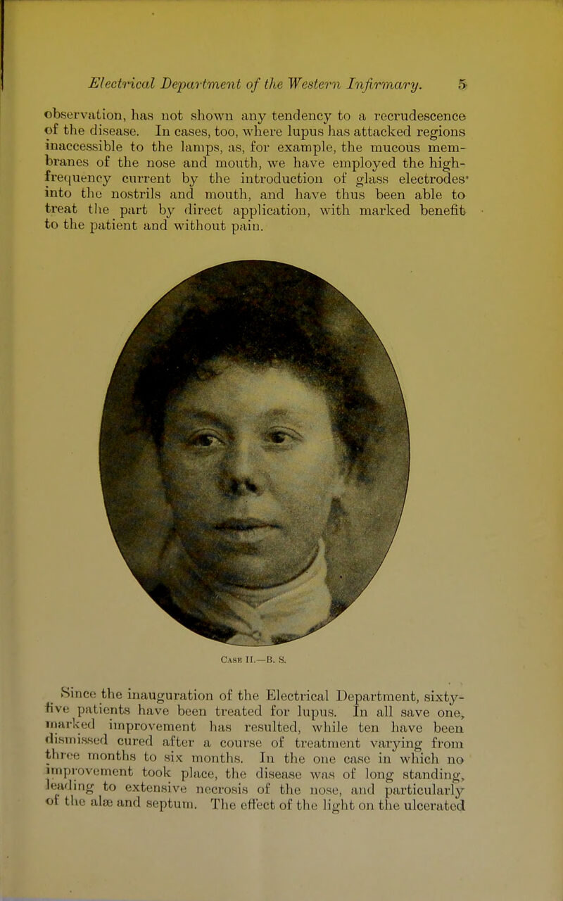 observation, has not shown any tendency to a recrudescence of the disease. In cases, too, where lupus has attacked regions inaccessible to the lamps, as, for example, the mucous mem- branes of the nose and mouth, we have employed the high- fre(|Uency current by the introduction of glass electrodes' into the nostrils and mouth, and have thus been able to treat the part by direct application, with marked benefit to the patient and without pain. Cask II.—B. S. Since the inauguration of the Electrical Department, sixty- live patients have been treated for lupus. In all save one, Tnarked improvement has resulted, while ten have been disnii.s.sed cured after a course of treatment varying from three months to six months. In the one case in which no improvement took place, the disease was of long standing, Jeadmg to extensive necrosis of the nose, and particularly of the alje and septum. Tlie effect of the light on the ulcerated