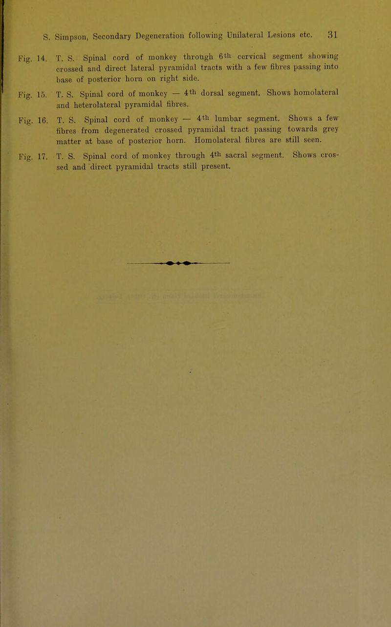 Fig. 14. T. S. Spinal cord of monkey through 6tli cervical segment showing crossed and direct lateral pyramidal tracts with a few fibres passing into base of posterior horn on right side. Fig. 15. T. S. Spinal cord of monkey — 4tli dorsal segment. Shows homolateral and heterolateral pyramidal fibres. Fig. 16. T. S. Spinal cord of monkey — 4th himbar segment. Shows a few fibres from degenerated crossed pyramidal tract passing towards grey matter at base of posterior horn. Homolateral fibres are still seen. Fig. 17. T. S. Spinal cord of monkey through 4th sacral segment. Shows cros- sed and direct pyramidal tracts still present.