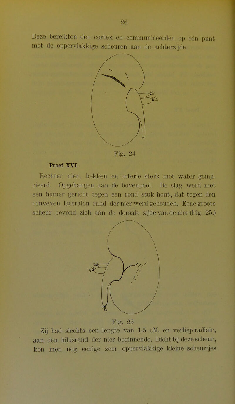 Deze bereikten den cortex en communiceerden op één punt met de oppervlakkige scheuren aan de achterzijde. Fig. 24 Proef XVI. Rechter nier, bekken en arterie sterk met water geinji- cieerd. Opgehangen aan de bovenpool. De slag werd met een hamer gericht tegen een rond stuk hout, dat tegen den convexen lateralen rand der nier wei'd gehouden. Eenegroote scheur bevond zich aan de dorsale zijde van de nier (Fig. 25.) Fig. 25 Zij had slechts een lengte van 1.5 cM. en verliep radiair, aan den hilusrand der nier beginnende. Dicht bij deze scheur, kon men nog eenige zeer oppervlakkige kleine scheurtjes