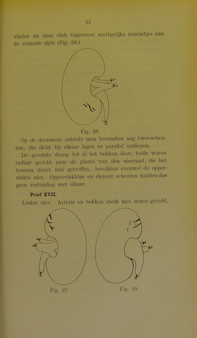 vindon en daar vlak tegenover soortgelijke scheurtjes aan de ventrale zijde (Fig. 26.) Fig. 26 Op de doorsnede ontdekt men bovendien nog twee scheu- ren, die dicht bij elkaar lagen en parallel verliepen. De grootste drong tot in het bekken door, beide waren radiair gericht naar de plaats van den niei'rand, die het trauma direct had getroffen, bert^ikten evenwel de opper- vlakte niet. Oppervlakkige en diepere scheuren hadden dus geen verbinding raet elkaar. Proef XVII. Linker nier. Arterie en bekken sterk met water gevuld, Fig. 27 Fig. 28