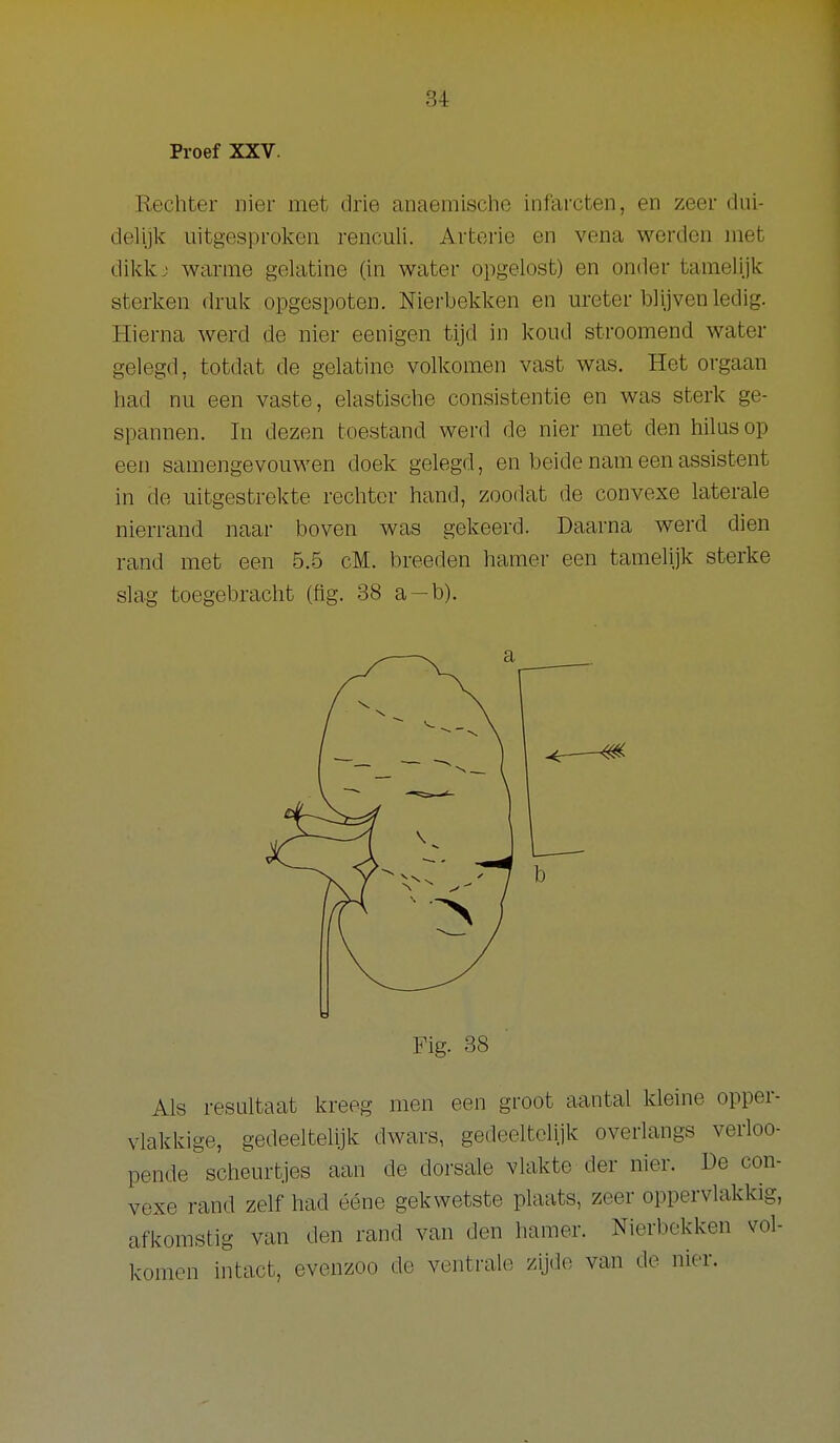 Proef XXV. Rechter nier met drie anaemische infarcten, en zeer dui- delijk uitgesproken renculi. Arterie en vena werden met dilckj warme gelatine (in water opgelost) en onder tamelijk sterken druk opgespoten. Nierbekken en ureter blijven ledig. Hierna werd de nier eenigen tijd in koud stroomend water gelegd, totdat de gelatine volkomen vast was. Het orgaan had nu een vaste, elastische consistentie en was sterk ge- spannen. In dezen toestand werd de nier met den hilusop een samengevouwen doek gelegd, en beide nam een assistent in de uitgestrekte rechter hand, zoodat de convexe laterale nierrand naar boven was gekeerd. Daarna werd dien rand met een 5.5 cM. broeden hamer een tamelijk sterke slag toegebracht (fig. 38 a —b). ^ ^ Fig. 38 Als resultaat kreeg men een groot aantal kleine opper- vlakkige, gedeeltelijk dwars, gedeeltelijk overlangs verloo- pende scheurtjes aan de dorsale vlakte der nier. De con- vexe rand zelf had ééne gekwetste plaats, zeer oppervlakldg, afkomstig van den rand van den hamer. Nierbekken vol- komen intact, evenzoo do ventrale zijde van de nier.