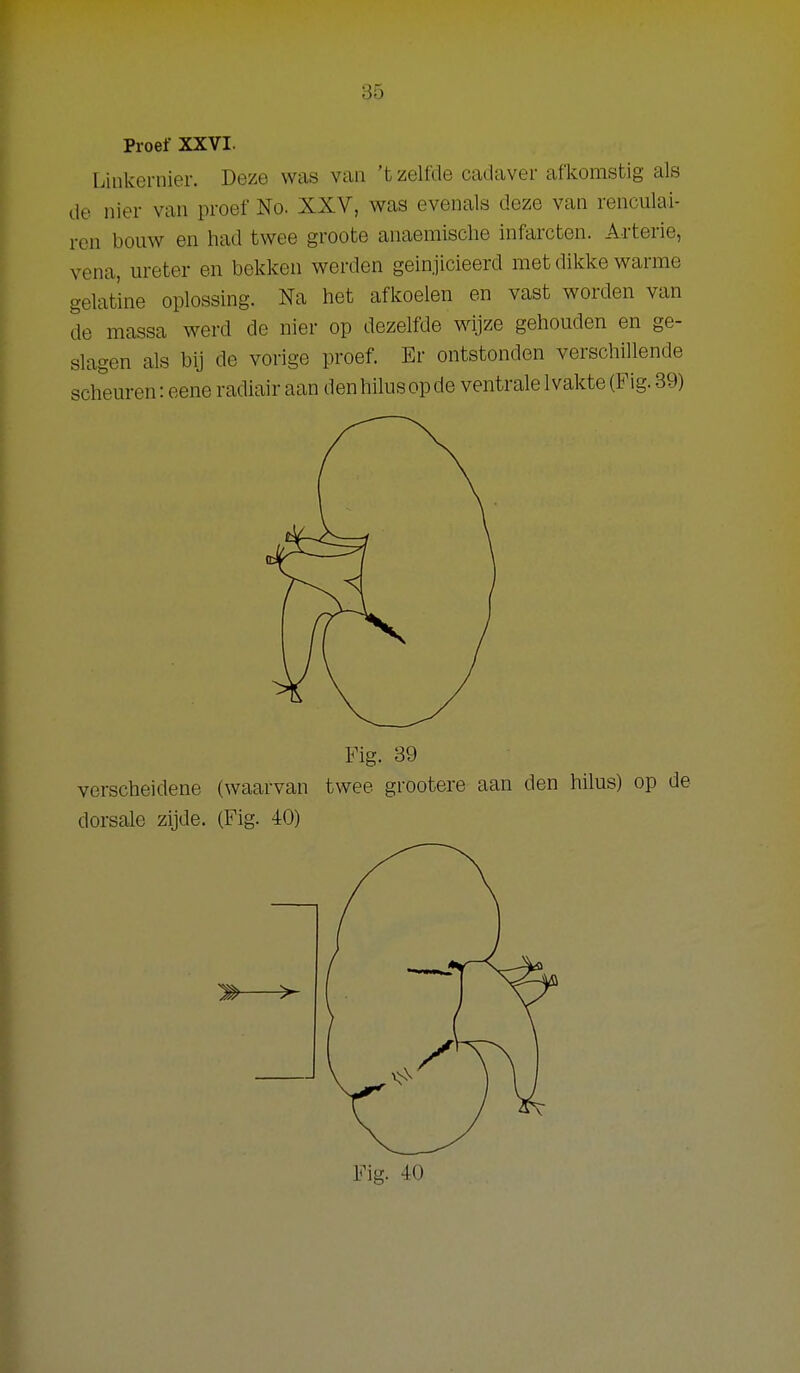 Proef XXVI. Linkernier. Deze was van 't zelfde cadaver afkomstig als de nier van proef No. XXV, was evenals deze van renculai- rcn bouw en had twee groote anaemische infarcten. Arterie, vena, ureter en bekken werden geinjicieerd met dikke warme gelatine oplossing. Na het afkoelen en vast worden van de massa werd de nier op dezelfde wijze gehouden en ge- slagen als bij de vorige proef. Er ontstonden verschillende scheuren: eene radiair aan denhilusopde ventralelvakte(Fig. 39) Fig. 39 verscheidene (waarvan twee grootere aan den hilus) op de dorsale zijde. (Fig. 40) > ^