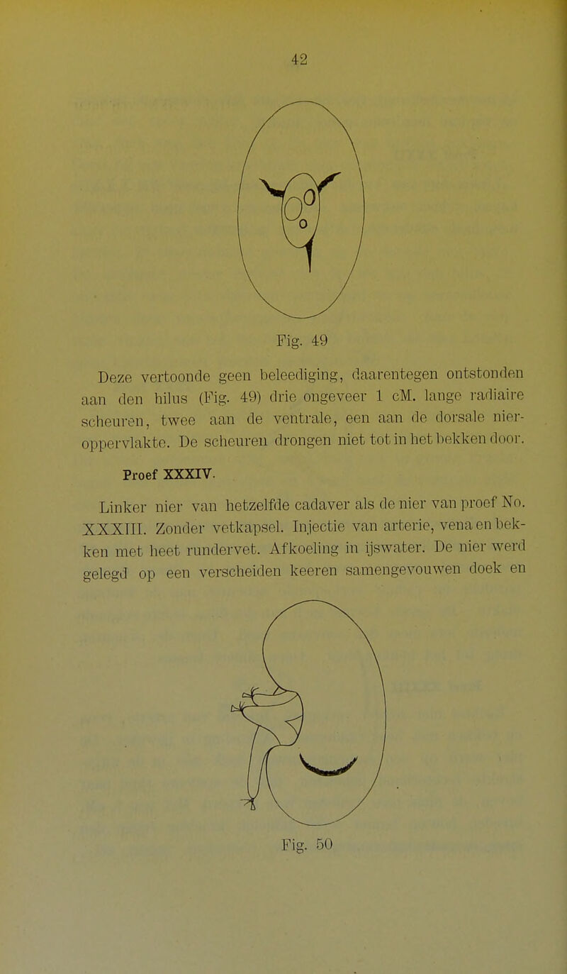 Fig. 49 Deze vertoonde geen beleediging, daarentegen ontstonden aan den hilus (Fig. 49) drie ongeveer 1 cM. lange radiaire scheuren, twee aan de ventrale, een aan de dorsale nier- oppervlakte. De scheuren drongen niet tot in het bekken door. Proef XXXIV. Linker nier van hetzelfde cadaver als de nier van proef No. XXXTII. Zonder vetkapsel. Injectie van arterie, vena en hek- ken met heet rundervet. Afkoeling in ijswater. De nier werd gelegd op een verscheiden keeren samengevouwen doek en