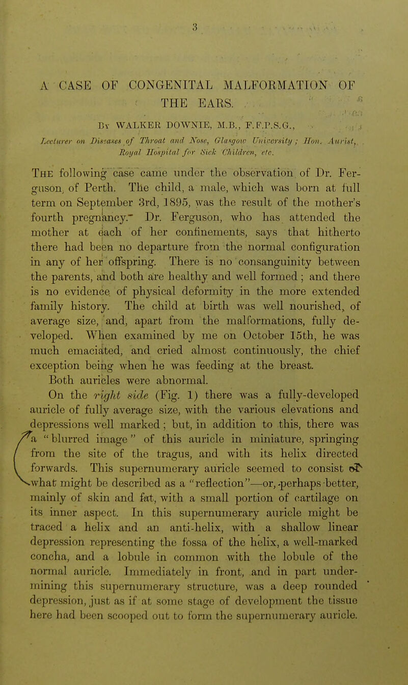 A CASE OF CONGENITAL MALFORMATION OF THE EARS. ■■' Bv WALKER DOWNIE, M.B., F.F.P.S.G., ■ • ;, j Lcclurer on Bis^axes of Throat and Kose, Glasgoio Uuinersity; Hon. Aurist, . Royal Hospital for tSiek Children, etc. The following case came under the observation, of Dr. Fer- guson, of Perth. The child, a male, which was born at iull term on September 3rd, 1895, was the result of the mother's fourth pregn'ancy. Dr. Ferguson, who has attended the mother at each of her confinements, says that hitherto there had been no departure from the normal configuration in any of her offspring. There is no consanguinity between the parents, and both aire healthy and well formed; and there is no evidence of physical deformity in the more extended family history. The child at birth was well nourished, of average size, and, apart from the malformations, fully de- veloped. When examined by me on October 15th, he was much emaciated, and cried almost continuously, the chief exception being when he Avas feeding at the breast. Both auricles were abnormal. On the right side (Fig. 1) there was a fully-developed auricle of fully average size, with the various elevations and depressions well marked; but, in addition to this, there was a blurred image of this auricle in miniature, springing from the site of the tragus, and with its hehx directed forwards. This supernumerary auricle seemed to consist oT •what might be described as a reflection—or,-perhaps better, mainly of skin and fet, with a small portion of cartilage on its inner aspect. In this supernumerary auricle might be traced a helix and an anti-helix, with a shallow linear depression representing the fossa of the helix, a well-marked concha, and a lobule in common with the lobule of the normal auricle. Immediately in front, and in part under- mining this supernumerary structure, was a deep rounded depression, just as if at some stage of development the tissue here had been scooped out to fonn the superniuncrary auricle.