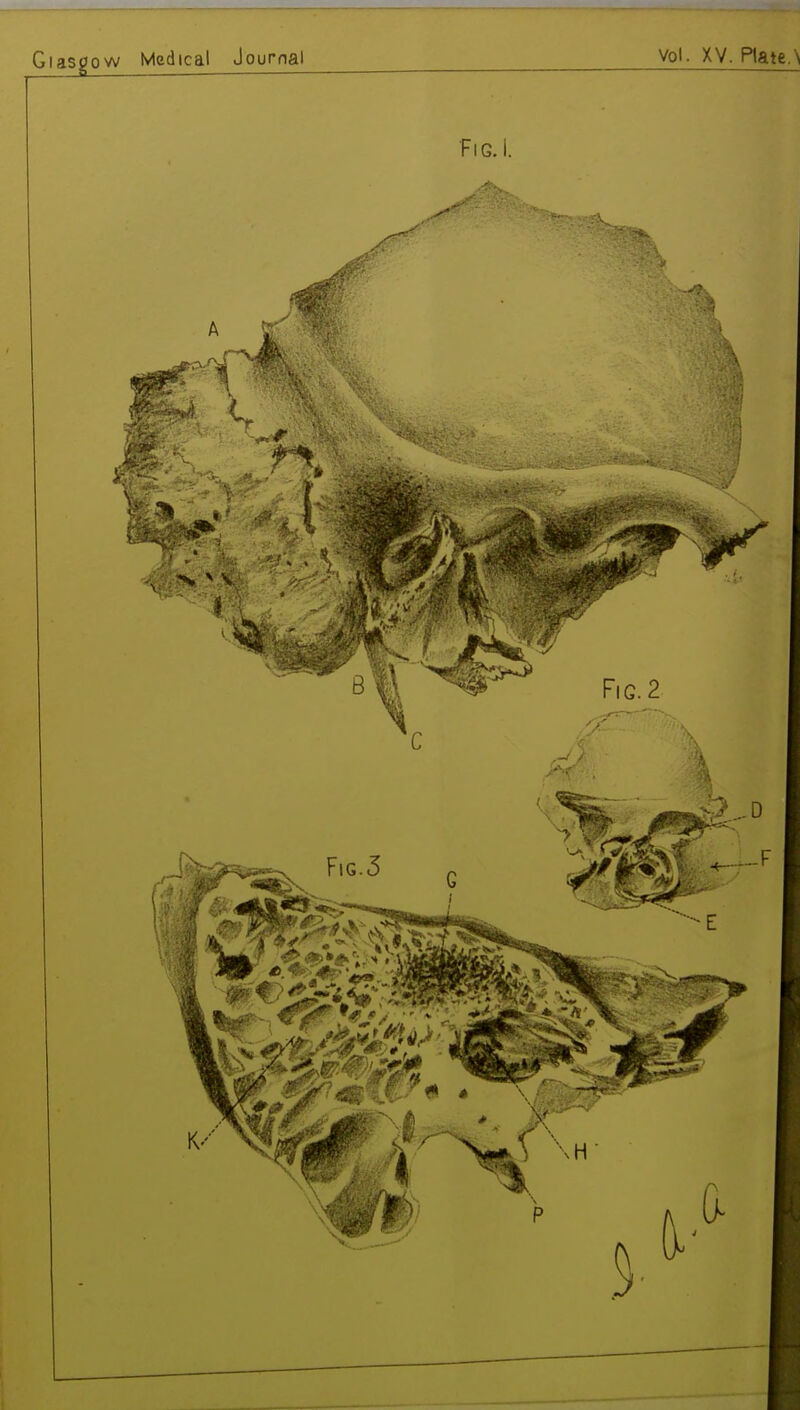 Glasgow Medical Journal vol. XV. Plate.\ Fig. i.