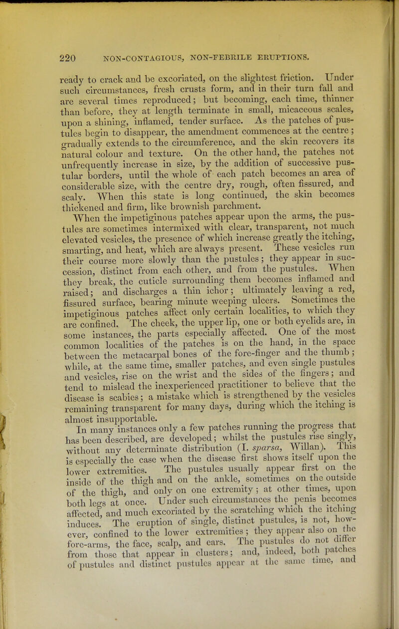 ready to crack and be excoriated, on the slightest friction. Under such circumstances, fresh crusts form, and in their turn fall and are several times reproduced; but becoming, each time, thinner than before, they at length terminate in small, micaceous scales, upon a shining, inflamed, tender surface. As the patches of pus- tules begin to disappear, the amendment commences at the centre; o-radually extends to the circumference, and the skin recovers its natural colour and texture. On the other hand, the patches not unfrequently increase in size, by the addition of successive pus- tular borders, until the whole of each patch becomes an area of considerable size, with the centre dry, rough, often fissured, and scaly. When this state is long continued, the skin becomes thickened and firm, like brownish parchment. When the impetiginous patches appear upon the arms, the pus- tules are sometimes intermixed with clear, transparent, not much elevated vesicles, the presence of which increase greatly the itching, smarting, and heat, which are always present. These vesicles run their course more slowly than the pustules; they appear in suc- cession, distinct from each other, and from the pustules. When they break, the cuticle surrounding them becomes inflamed and raised; and discharges a thin ichor; ultimately leaving a red, fissured surface, bearing minute weeping ulcers. Sometimes the impetiginous patches affect only certain localities, to which they are confined. The cheek, the upper lip, one or both eyehds are, in some instances, the parts especially affected. One of the most common localities of the patches is on the hand, in the space between the metacarpal bones of the fore-finger and the thumb ; while, at the same time, smaller patches, and even single pustules and vesicles, rise on the wrist and the sides of the fingers; and tend to mislead the inexperienced practitioner to believe that the disease is scabies; a mistake which is strengthened by the vesicles remaining transparent for many days, during which the itchmg is almost insupportable. , In many instances only a few patches running the progress that has been described, are developed; whilst the pustules rise singly, without any determinate distribution (1. sparsa, Willan). ihis is especially the case when the disease first shows itself upon the lower extremities. The pustules usually appear first on the inside of the thigh and on the ankle, sometunes on the outside of the thio-h, and only on one extremity ; at other times, upon both legs at once. Under such circumstances the penis becomes affected, and much excoriated by the scratching which the itching induces The eruption of single, distinct pustules, is not, how- ever, confined to the lower extremities; they appear also on^le fore-arms, the face, scalp, and ears. The pustules do not cUtter from those that appear in clusters; and, indeed, both patcnes of pustules and distinct pustules appear at tlic same time, and