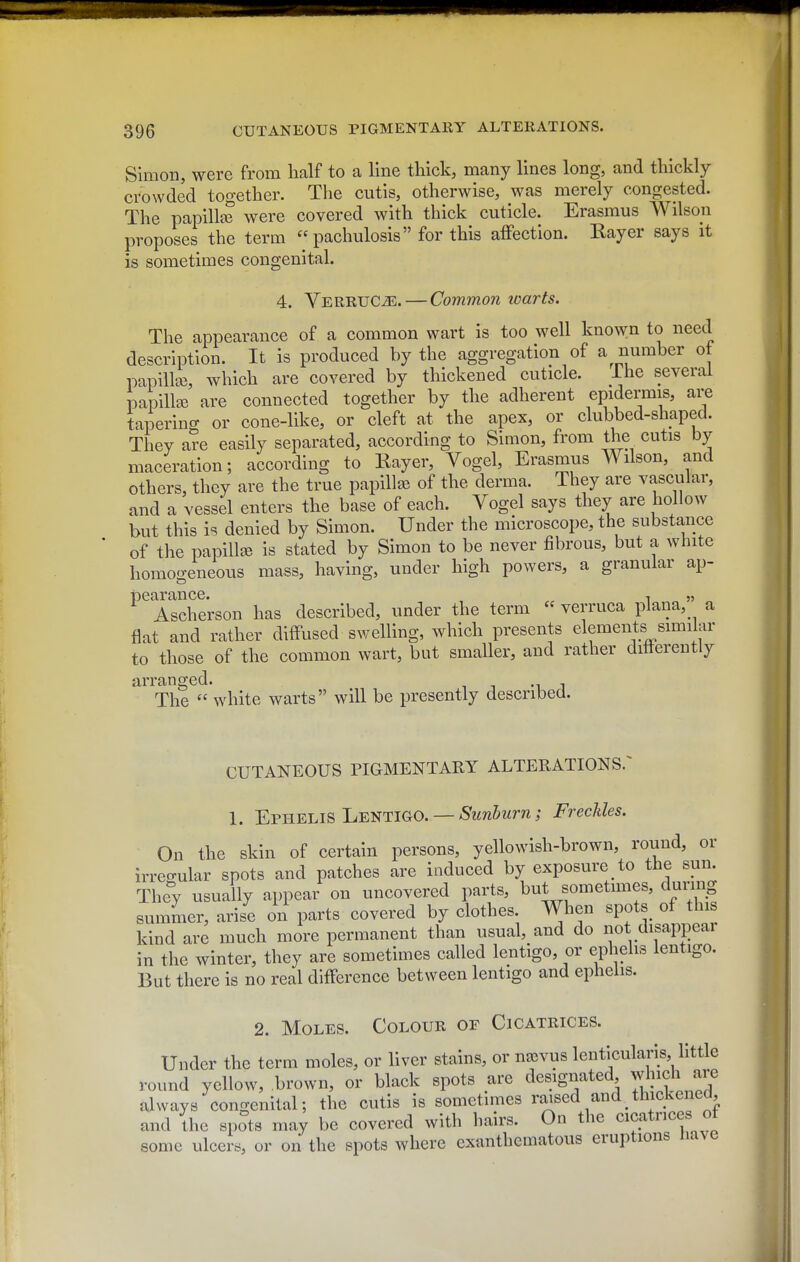 Simon, were from half to a line thick, many lines long, and thickly crowded together. The cutis, otherwise, was merely congested. The papillie were covered with thick cuticle. Erasmus Wilson proposes the term « pachulosis for this aiFection. Eayer says it is sometimes congenital. 4. VerruCuE. — Common loarts. The appearance of a common wart is too well known to need description. It is produced by the aggregation of a number of papillae, which are covered by thickened cuticle. The several papillae are connected together by the adherent epidermis, are tapering or cone-like, or cleft at the apex, or clubbed-shaped. They are easily separated, according to Simon, from the cutis by maceration; according to Rayer, Vogel, Erasmus Wilson, and others, they are the true papillae of the derma. They are vascular, and a vessel enters the base of each. Vogel says they are hollow but this is denied by Simon. Under the microscope, the substance of the papillae is stated by Simon to be never fibrous, but a white homogeneous mass, having, under high powers, a granular ap- pearance. 1 55 „ Ascherson has described, under the term  verruca plana, a flat and rather diffused swelling, Avhich presents elements similar to those of the common wart, but smaller, and rather ditterently arranged. The  white warts will be presently described. CUTANEOUS PIGMENTARY ALTERATIONS/ 1. EpheliS Lentigo. — 5'zm5wm; Freckles. On the skin of certain persons, yellowish-brown, round, or irreo-ular spots and patches are induced by exposure to the sun. They usually appear on uncovered parts, but sometimes, dunng summer, arise on parts covered by clothes. When spots of this kind are much more permanent than usual, and do not disappear in the winter, they are sometimes called lentigo, or ephelis lentigo. But there is no real difference between lentigo and ephehs. 2. Moles. Colour or Cicatrices. Under the term moles, or liver stains, or na>vus lentlcularis little round yellow, brown, or black spots are designated winch are always congenital; the cutis is sometimes raised and thickened, and the sp?ts may be covered with hairs. On the cicatrices ot some ulcers, or on the spots where exanthematous eruptions nave