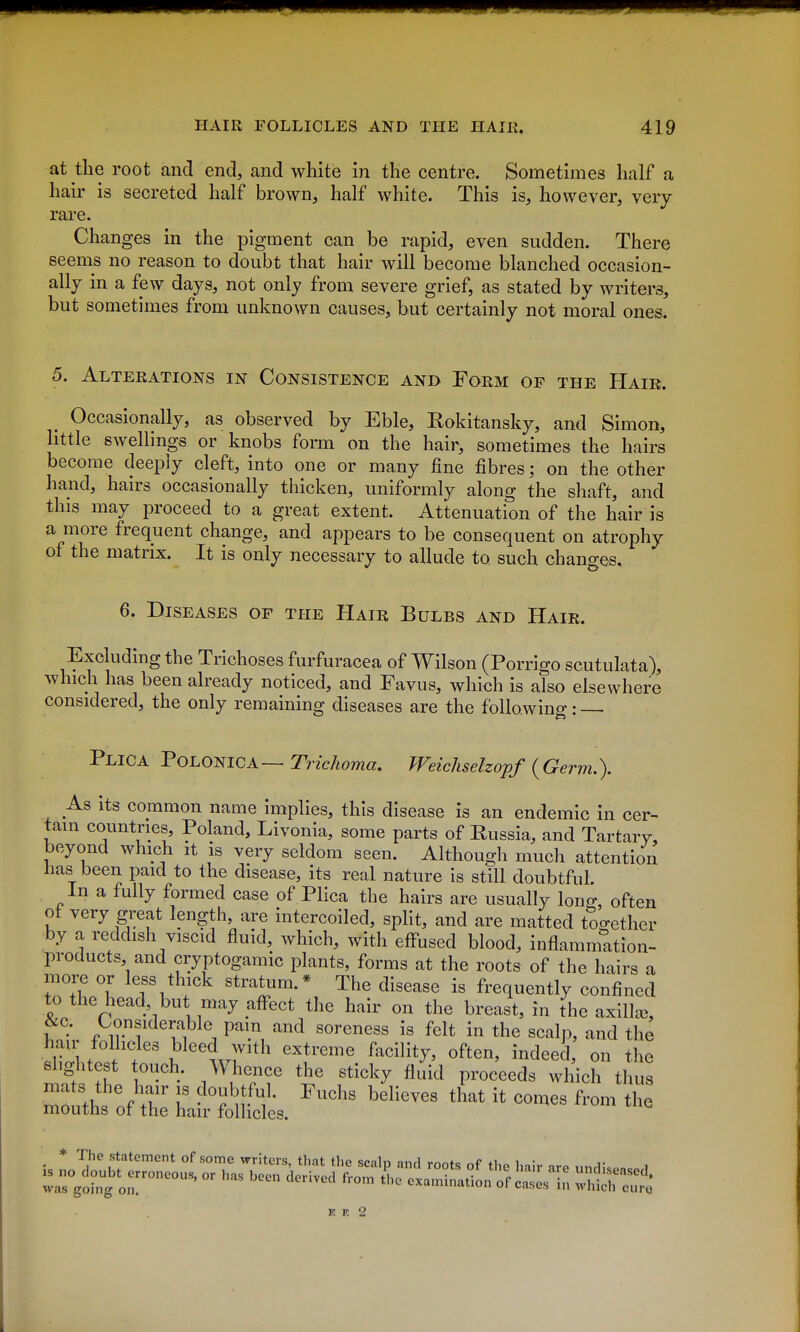at the root and end, and white in the centre. Sometimes half a hair is secreted half brown, half white. This is, however, very rare. Changes in the pigment can be rapid, even sudden. There seems no reason to doubt that hair will become blanched occasion- ally in a few days, not only from severe grief, as stated by writers, but sometimes from unknown causes, but certainly not moral ones. 5. Alterations in Consistence and Form op the Hair. Occasionally, as observed by Eble, Rokitansky, and Simon, tt e sw^elliUj^s or knobs form on the hair, sometimes the hairs become deeply cleft, into one or many fine fibres; on the other hand, hairs occasionally thicken, uniformly along the shaft, and this may proceed to a great extent. Attenuation of the hair is a more frequent change, and appears to be consequent on atrophy of the matrix. It is only necessary to allude to such changes. 6. Diseases op the Hair Bulbs and Hair. Excluding the Trichoses furfuracea of Wilson (Porrigo scutulata), which has been already noticed, and Favus, which is also elsewhere considered, the only remaining diseases are the following: Plica FoLomcA—Trichoma. Weichselzopf {Germ.). As its common name implies, this disease is an endemic in cer- tain countries, Poland, Livonia, some parts of Russia, and Tartarv, beyond which it is very seldom seen. Although much attention has been paid to the disease, its real nature is still doubtful. In a fully formed case of Plica the hairs are usually lonff, often of very great length, are intercoiled, split, and are matted together by a reddish viscid fluid, which, with eflused blood, inflammation- products and cryptogamic plants, forms at the roots of the hairs a more or less thick stratum.* The disease is frequently confined to the head but may affect the hair on the breast, in the axillce, &c. Considerable pam and soreness is felt in the scalp, and the hair follicles bleed with extreme facility, often, indeed, on the slightest t<)uch. Whence the sticky fluid proceeds which thus ^^^Z^t^^ ^-^^ that it comes from the was going on.