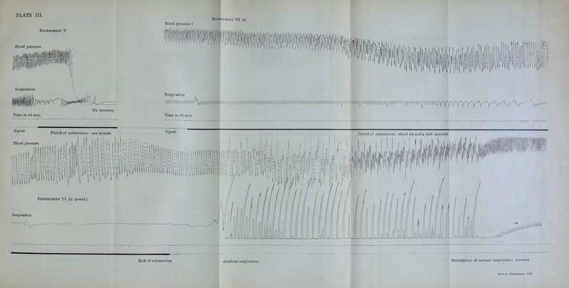 Experiment V Blood pressure Blood pressure 1 EXPBHIMENT VI (6) j ' ' ' ' I ' 1 i ' I ^ 1' I t I iji'llil ill ni'> I 111 Respiration Kg recovery Time in 10 sees. Signal Period of submersion: one minute Blood Dressure Respiration MM-MAUmilij] ■lA^Ul/Wli' Time in 10 sees. Signal Period of submersion : about six and a half minutea '•■ , ii' ,< m: 'th' ,, 1 II imMn Ead of submersion Resumption of nacural respiration: recovery