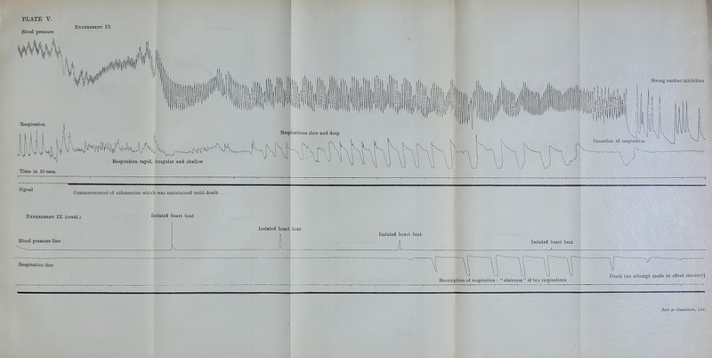 Blood pressure ExPKBniENT IX strong cardiac inhibition Respiration rapid, irregular and shallow Time in 10 sees. Signal Commencement of submersion which was maintained until death ExPEBmEirr IX {contd.) Blood pressure line Isolated heart beat Isolated heart 1^ boat Isolated heart beat Isolated heart beat Bespiration line Resumption of respiration :  staircase  of ten respirations V Peath {no attempt made to eifect recovery) £a/e ir* Dam'elsstm^ Ltd.,