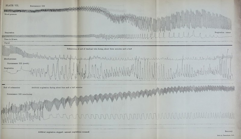 Blood pressure EXPEBIWENT XII BespiratioD Time in 10 sees. Signal •ion ceases hi: Submersion of end of tracheal tube daring about three minutes and a half Blood pressure Respiration Artificial respiration stopped: natural respirations resumed Recovery Ba/f (5r> DantelssoH, Lid..