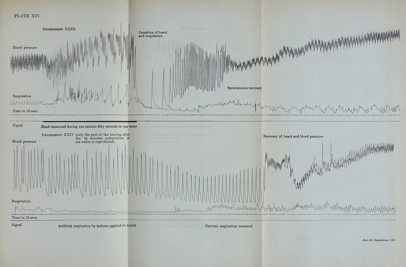 EXPBBIMENT y XI T \ Blood pressure ^Fime in 10 sees, Time in 10 Signal Artificial respiration by bellows applied to nostril Natural respiration resumed