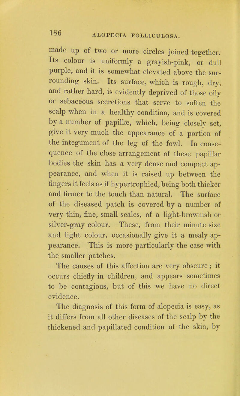 made up of two or more circles joined together. Its colour is uniformly a grayish-pink, or dull purple, and it is somewhat elevated above the sur- rounding skin. Its surface, which is rough, dry, and rather hard, is evidently deprived of those oily or sebaceous secretions that serve to soften the scalp when in a healthy condition, and is covered by a number of papillae, which, being closely set, give it very much the appearance of a portion of the integument of the leg of the fowl. In conse- quence of the close arrangement of these papillar bodies the skin has a very dense and compact ap- pearance, and when it is raised up between the fingers it feels as if hypertrophied, being both thicker and firmer to the touch than natural. The surface of the diseased patch is covered by a number of very thin, fine, small scales, of a light-brownish or silver-gray colour. These, from their minute size and light colour, occasionally give it a mealy ap- pearance. This is more particularly the case with the smaller patches. The causes of this affection are very obscure; it occurs chiefly in children, and appears sometimes to be contagious, but of this we have no direct evidence. The diagnosis of this form of alopecia is easy, as it differs from all other diseases of the scalp by the thickened and papillated condition of the skin, by