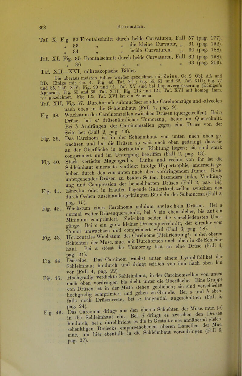 Taf. X, Fig. 32 Frontalschnitt durch beide Curvaturen, Fall 57 (pag. 177). 33 n „ die kleine Curvatur, „ 61 (pag. 192).  34 „ „ beide Curvaturen, „ 60 (pag. 188). Taf XI Fisr 35 Frontalschnitt durch beide Curvaturen, Fall 62 (pag. 198). ' ' 36 ,, „ n n n ^ (pag. 203). Taf. XII—XVI, mikroskopische Bilder. Die überaus meisten Bilder wurden gezeichnet mit Zeiss, 0c. 2. Obj AA und DD Einige mit Oc. 4. Fig. 48, Taf. XII; Fig. 58, 61 und 62, Taf. XIII; Fig. 77 und Taf XIV- Fig 90 und 91, Taf. XV sind bei Lupenvergrösserung (Edmgers Zpafat) Fig 55'und'69 Taf. XIII; Fig. 113 und 121, Taf. XVI mit homog. Mm. Vie gezeichnet. Fig. 125, Taf. XVI ist ein Schema. Taf. XII, Fig. 37. Durchbruch submucöser solider Carcinomzüge und -alveolen 'nach oben in die Schleimhaut (Fall 1, pag. 9). Fig 38 Wachstum der Carcinomzellen zwischen Drüsen (quergetroffen). Bei a Drüse, bei a' drüsenähnlicher Tumorzug, beide im Querschnitt, Bei ^Andrängen der Carcinomzellen gegen eine Drüse von der Seite her (Fall 2, pag. 13). Fig 39 Das Carcinom ist in der Schleimhaut von unten nach oben ge- wachsen und hat die Drüsen so weit nach oben gedrängt, dass sie an der Oberfläche in horizontaler Richtung liegen; sie sind stark comprimiert und im Untergang begriffen (Fall 2, pag. 13). _ Fig 40 Stark vertiefte Magengrube. Links und rechts von ihr ist die Schleimhaut einerseits verdickt infolge Hypertrophie, anderseits ge- hoben durch den von unten nach oben vordringenden Tumor. Reste untergehender Drüsen zu beiden SeiteD, besonders links, Verdräng- ung und Compression der benachbarten Drüsen (Fall 2, pag. 14). Fig 41. Einzelne oder in Haufen liegende Gallertkrebszellen zwischen den durch Oedem auseinandergedrängten Bündeln der Submucosa (b all 2, Fig 42 Wachstum eines Carcinoma solidum zwischen Drüsen. Bei a normal weiter Drüsenquerschnitt, bei b ein ebensolcher, bis auf ein Minimum comprimiert. Zwischen beiden die verschiedensten Uber- gänge. Bei c ein ganz kleiner Drüsenquerschnitt, der circular vom Tumor umwachsen und comprimiert wird (Fall 3, pag. 18). Fig 43 Horizontales Wachstum des Carcinoms (Pfeilrichtung!) in den oberen ' Schichten der Muse. muc. mit Durchbruch nach oben in die Schleim- haut. Bei a stösst der Tumorzug fast an eine Druse (Fall 4, Fig 44 Dagsse2lbe. Das Carcinom wächst unter einem Lymphfollikel der ' Schleimhaut hindurch und dringt seitlich von ihm nach oben hin Fie 45 Hochgradig verdickt Schleimhaut, in der Carcinomzellen von unten g' fach oben vordringen bis dicht unter die Oberfläche. Eine Gruppe von Drüsen ist in der Mitte stehen geblieben; sie sind verschieden hochgradig comprimiert und gehen zu Grunde. Bei a und 5 eben- falls noch Drüsenreste, bei a tangential angeschnitten (Sali 5, Fig 46. Z Carcinom dringt aus den oberen Schichten der Muse, mucjM g in die Schleimhaut ein. Bei d dringt es zwischen den Drusen hindurch, bei c durchbricht ^l^^^f^^/St^ schenkligen Dreiecks emporgehobenen oberen Lamellen der*lue. muc, um hier ebenfalls in die Schleimhaut vorzudringen (Fall 6,