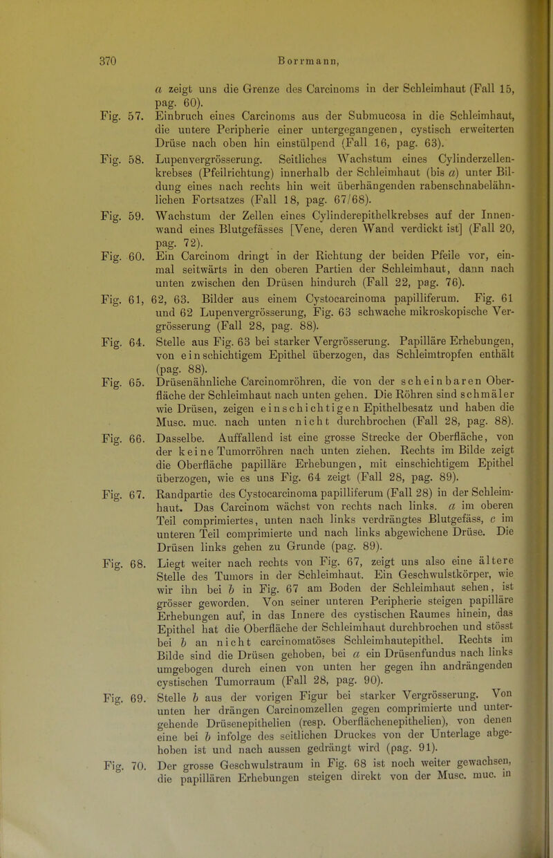 a zeigt uns die Grenze des Carcinoms in der Schleimhaut (Fall 15, pag. 60). Fig. 57. Einbruch eines Carcinoms aus der Submucosa in die Schleimhaut, die untere Peripherie einer untergegangenen, cystisch erweiterten Drüse nach oben hin einstülpend (Fall 16, pag. 63). Fig. 58. Lupenvergrösserung. Seitliches Wachstum eines Cylinderzellen- krebses (Pfeilrichtung) innerhalb der Schleimhaut (bis a) unter Bil- dung eines nach rechts hin weit überhängenden rabenschnabelähn- lichen Fortsatzes (Fall 18, pag. 67/68). Fig. 59. Wachstum der Zellen eines Cylinderepithelkrebses auf der Innen- wand eines Blutgefässes [Vene, deren Wand verdickt ist] (Fall 20, pag. 72). Fig. 60. Ein Carcinom dringt in der Richtung der beiden Pfeile vor, ein- mal seitwärts in den oberen Partien der Schleimhaut, dann nach unten zwischen den Drüsen hindurch (Fall 22, pag. 76). Fig. 61, 62, 63. Bilder aus einem Cystocarcinoma papilliferum. Fig. 61 und 62 Lupenvergrösserung, Fig. 63 schwache mikroskopische Ver- grösserung (Fall 28, pag. 88). Fig. 64. Stelle aus Fig. 63 bei starker Vergrösserung. Papilläre Erhebungen, von einschichtigem Epithel überzogen, das Schleimtropfen enthält (pag. 88). Fig. 65. Drüsen ähnliche Carcinomröhren, die von der s ch ei n b aren Ober- fläche der Schleimhaut nach unten gehen. Die Röhren sind schmäler wie Drüsen, zeigen einschichtigen Epithelbesatz und haben die Muse. muc. nach unten nicht durchbrochen (Fall 28, pag. 88). Fig. 66. Dasselbe. Auffallend ist eine grosse Strecke der Oberfläche, von der kei ne Tumorröhren nach unten ziehen. Rechts im Bilde zeigt die Oberfläche papilläre Erhebungen, mit einschichtigem Epithel überzogen, wie es uns Fig. 64 zeigt (Fall 28, pag. 89). Fig. 67. Randpartie des Cystocarcinoma papilliferum (Fall 28) in der Schleim- haut. Das Carcinom wächst von rechts nach links, a im oberen Teil comprimiertes, unten nach links verdrängtes Blutgefäss, c im unteren Teil comprimierte und nach links abgewichene Drüse. Die Drüsen links gehen zu Grunde (pag. 89). Fig. 68. Liegt weiter nach rechts von Fig. 67, zeigt uns also eine ältere Stelle des Tumors in der Schleimhaut. Ein Geschwulstkörper, wie wir ihn bei b in Fig. 67 am Boden der Schleimhaut sehen, ist grösser geworden. Von seiner unteren Peripherie steigen papilläre Erhebungen auf, in das Innere des cystischen Raumes hinein, das Epithel hat die Oberfläche der Schleimhaut durchbrochen und stösst bei b an nicht carcinomatöses Schleimhautepithel. Rechts im Bilde sind die Drüsen gehoben, bei a ein Drüsenfundus nach links umgebogen durch einen von unten her gegen ihn andrängenden cystischen Tumorraum (Fall 28, pag. 90). Fig. 69. Stelle b aus der vorigen Figur bei starker Vergrösserung. Von unten her drängen Carcinomzellen gegen comprimierte und unter- gehende Drüsenepithelien (resp. Oberflächenepithelien), von denen eine bei b infolge des seitlichen Druckes von der Unterlage abge- hoben ist und nach aussen gedrängt wird (pag. 91). Fig. 70. Der grosse Geschwulstraum in Fig. 68 ist noch weiter gewachsen, die papillären Erhebungen steigen direkt von der Muse. muc. in