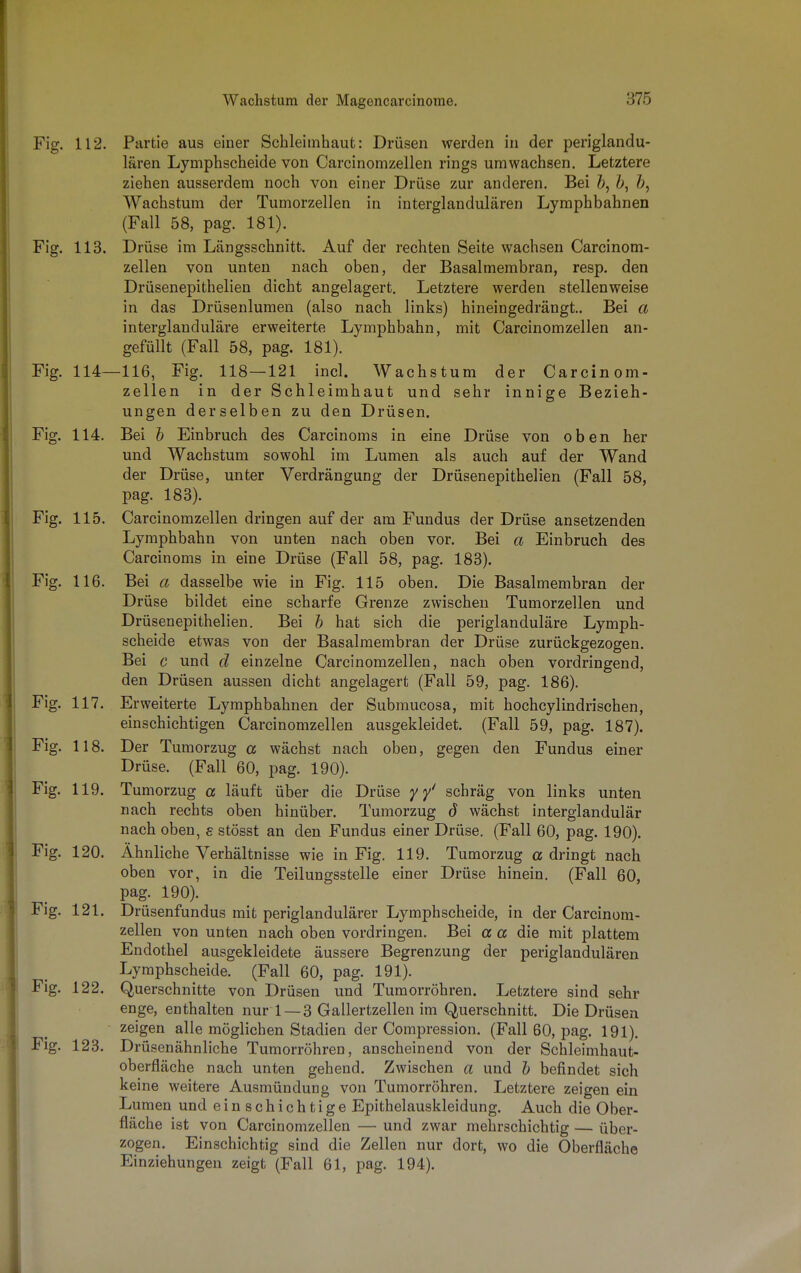 Fig. 112. Partie aus einer Schleimhaut: Drüsen werden in der periglandu- lären Lymphscheide von Carcinomzellen rings umwachsen. Letztere ziehen ausserdem noch von einer Drüse zur anderen. Bei fr, fr, &, Wachstum der Tumorzellen in interglandulären Lymphbahnen (Fall 58, pag. 181). Fig. 113. Drüse im Längsschnitt. Auf der rechten Seite wachsen Carcinom- zellen von unten nach oben, der Basalmembran, resp. den Drüsenepithelien dicht angelagert. Letztere werden stellenweise in das Drüsenlumen (also nach links) hineingedrängt.. Bei a interglanduläre erweiterte Lymphbahn, mit Carcinomzellen an- gefüllt (Fall 58, pag. 181). Fig. 114—116, Fig. 118—121 incl. Wachstum der Carcinom- zellen in der Schleimhaut und sehr innige Bezieh- ungen derselben zu den Drüsen. Fig. 114. Bei b Einbruch des Carcinoms in eine Drüse von oben her und Wachstum sowohl im Lumen als auch auf der Wand der Drüse, unter Verdrängung der Drüsenepithelien (Fall 58, pag. 183). Fig. 115. Carcinomzellen dringen auf der am Fundus der Drüse ansetzenden Lymphbahn von unten nach oben vor. Bei a Einbruch des Carcinoms in eine Drüse (Fall 58, pag. 183). Fig. 116. Bei a dasselbe wie in Fig. 115 oben. Die Basalmembran der Drüse bildet eine scharfe Grenze zwischen Tumorzellen und Drüsenepithelien. Bei h hat sich die periglanduläre Lymph- scheide etwas von der Basalmembran der Drüse zurückgezogen. Bei c und d einzelne Carcinomzellen, nach oben vordringend, den Drüsen aussen dicht angelagert (Fall 59, pag. 186). Fig. 117. Erweiterte Lymphbahnen der Submucosa, mit hochcylindrischen, einschichtigen Carcinomzellen ausgekleidet. (Fall 59, pag. 187). Fig. 118. Der Tumorzug a wächst nach oben, gegen den Fundus einer Drüse. (Fall 60, pag. 190). Fig. 119. Tumorzug a läuft über die Drüse y y' schräg von links unten nach rechts oben hinüber. Tumorzug d wächst interglandulär nach oben, s stösst an den Fundus einer Drüse. (Fall 60, pag. 190). Fig. 120. Ähnliche Verhältnisse wie in Fig. 119. Tumorzug a dringt nach oben vor, in die Teilungsstelle einer Drüse hinein. (Fall 60, pag. 190). Fig. 121. Drüsenfundus mit periglandulärer Lymphscheide, in der Carcinom- zellen von unten nach oben vordringen. Bei a a die mit plattem Endothel ausgekleidete äussere Begrenzung der periglandulären Lymphscheide. (Fall 60, pag. 191). Fig. 122. Querschnitte von Drüsen und Tumorröhren. Letztere sind sehr enge, enthalten nur 1 — 3 Gallertzellen im Querschnitt. Die Drüsen zeigen alle möglichen Stadien der Compression. (Fall 60, pag. 191). Fig. 123. Drüsenähnliche Tumorröhren, anscheinend von der Schleimhaut- oberfläche nach unten gehend. Zwischen a und b befindet sich keine weitere Ausmündung von Tumorröhren. Letztere zeigen ein Lumen und einschichtige Epithelauskleidung. Auch die Ober- fläche ist von Carcinomzellen — und zwar mehrschichtig — über- zogen. Einschichtig sind die Zellen nur dort, wo die Oberfläche Einziehungen zeigt (Fall 61, pag. 194).