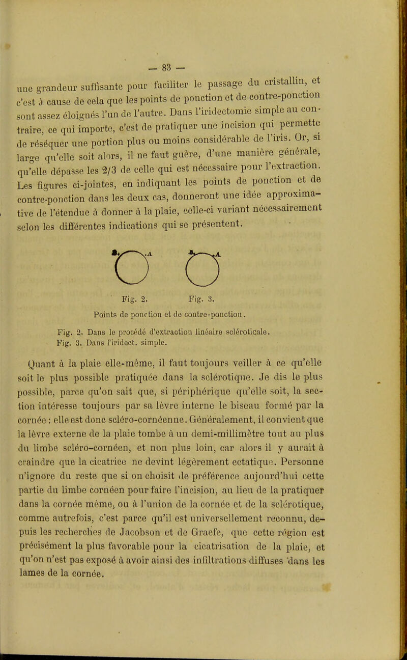 - 88 — une grandeur suffisante pour faciliter le passage du cristallin, et c'est à cause de cela que les points de ponction et de contre-ponction sont assez éloignés l'un de l'autre. Dans l'iridectomie simple au con- traire, ce qui importe, c'est de pratiquer une incision qui permette de réséquer une portion plus ou moins considérable de l'iris. Or, si large qu'elle soit alors, il ne faut guère, d'une manière générale, qu'elle dépasse les 2/3 de celle qui est nécessaire pour l'extraction. Les figures ci-jointes, en indiquant les points de ponction et de contre-ponction dans les deux cas, donneront une idée approxima- tive de l'étendue à donner à la plaie, celle-ci variant nécessairement selon les différentes indications qui se présentent. Fig. 2. Fig. 3. Points de ponction et de contre-ponction. Fig. 2. Dans le procédé d'oxtraotion linéaire scléroticale. Fig. 3. Dans l'iridect. simple. Quant à la plaie elle-même, il faut toujours veiller à ce qu'elle soit le plus possible pratiquée dans la sclérotique. Je dis le plus possible, parce qu'on sait que, si périphérique qu'elle soit, la sec- tion intéresse toujours par sa lèvre interne le biseau formé par la cornée : elle est donc scléro-cornéenne. Généralement, il convient que la lèvre externe de la plaie tombe à un demi-millimètre tout au plus du limbe scléro-cornéen, et non plus loin, car alors il y aurait à craindre que la cicatrice ne devint légèrement ectatique. Personne n'ignore du reste que si on choisit de préférence aujourd'hui cette partie du limbe cornéen pour faire l'incision, au lieu de la pratiquer dans la cornée même, ou à l'union de la cornée et de la sclérotique, comme autrefois, c'est parce qu'il est universellement reconnu, de- puis les recherches de Jacobson et de Graefe, que cette région est précisément la plus favorable pour la cicatrisation de la plaie, et qu'on n'est pas exposé à avoir ainsi des infiltrations diffuses 'dans les lames de la cornée.