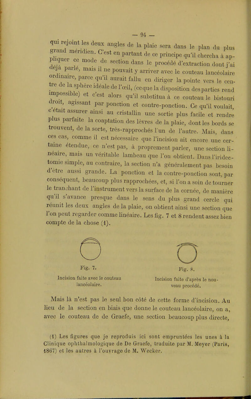 qui rejoint les deux angles de la plaie sera dans le plan du plus grand méridien. C'est en partant de ce principe qu'il chercha à ap- pliquer ce mode de section dans le procédé d'extraction dont j'ai déjà parle, mais il ne pouvait y arriver avec le couteau lancéolaire ordinaire, parce qu'il aurait fallu en diriger la pointe vers le cen- tre de la sphère idéale de l'œil, (ce que la disposition des parties rend impossible) et c'est alors qu'il substitua à ce couteau le bistouri droit, agissant par ponction et contre-ponction. Ce qu'il voulait c était assurer ainsi au cristallin une sortie plus facile et rendre plus parfaite la coaptation des lèvres de la plaie, dont les bords se trouvent, de la sorte, très-rapprochés l'un de l'autre. Mais, dans ces cas, comme il est nécessaire que l'incision ait encore une cer- taine étendue, ce n'est pas, à proprement parler, une section li- néaire, mais un véritable lambeau que l'on obtient. Dans l'iridee- tomie simple, au contraire, la section n'a généralement pas besoin d'être aussi grande. La ponction et la contre-ponction sont, par conséquent, beaucoup plus rapprochées, et, si l'on a soin détourner le tranchant de l'instrument vers la surface de la cornée, de manière qu'il s'avance presque dans le sens du plus grand cercle qui réunit les deux angles de la plaie, on obtient ainsi une section que l'on peut regarder comme linéaire. Les fig. 7 et 8 rendent assez bien compte de la chose (1). pig- Fig. 8. Incision faite avec le couteau Incision faite d'après le nou- lancéolaire. veau procédé. Mais là n'est pas le seul bon côté de cette forme d'incision. Au lieu de la section en biais que donne le couteau lancéolaire, on a, avec le couteau de de Graefe, une section beaucoup plus directe, (1) Les figures que je reproduis ici sont empruntées les unes à la Clinique ophthalmologique de De Graefe, traduite par M. Meyer (Paris, 1867) et les autres à l'ouvrage de M. Weckcr.