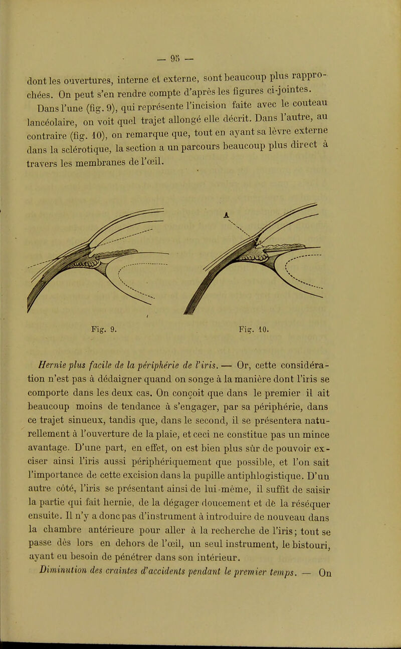 dont les ouvertures, interne et externe, sont beaucoup plus rappro- chées. On peut s'en rendre compte d'après les figures ci-jointes. Dans l'une (fig. 9), qui représente l'incision faite avec le couteau lancéolaire, on voit quel trajet allongé elle décrit. Dans l'autre, au contraire (fig. 10), on remarque que, tout en ayant sa lèvre externe dans la sclérotique, la section a un parcours beaucoup plus direct à travers les membranes de l'œil. Fig. 9. Fiç. 10. Hernie plus facile de la périphérie de l'iris. — Or, cette considéra- tion n'est pas à dédaigner quand on songe à la manière dont l'iris se comporte dans les deux cas. On conçoit que dans le premier il ait beaucoup moins de tendance à s'engager, par sa périphérie, dans ce trajet sinueux, tandis que, dans le second, il se présentera natu- rellement à l'ouverture de la plaie, et ceci ne constitue pas un mince avantage. D'une part, en effet, on est bien, plus sûr de pouvoir ex- ciser ainsi l'iris aussi périphériquement que possible, et l'on sait l'importance de cette excision dans la pupille antiphlogistique. D'un autre côté, l'iris se présentant ainsi de lui-même, il suffit de saisir la partie qui fait hernie, de la dégager doucement et de la réséquer ensuite. Il n'y a donc pas d'instrument à introduire de nouveau dans la chambre antérieure pour aller à la recherche de l'iris ; tout se passe dès lors en dehors de l'œil, un seul instrument, le bistouri, ayant eu besoin de pénétrer dans son intérieur. Diminution des craintes d'accidents pendant le premier temps. — On
