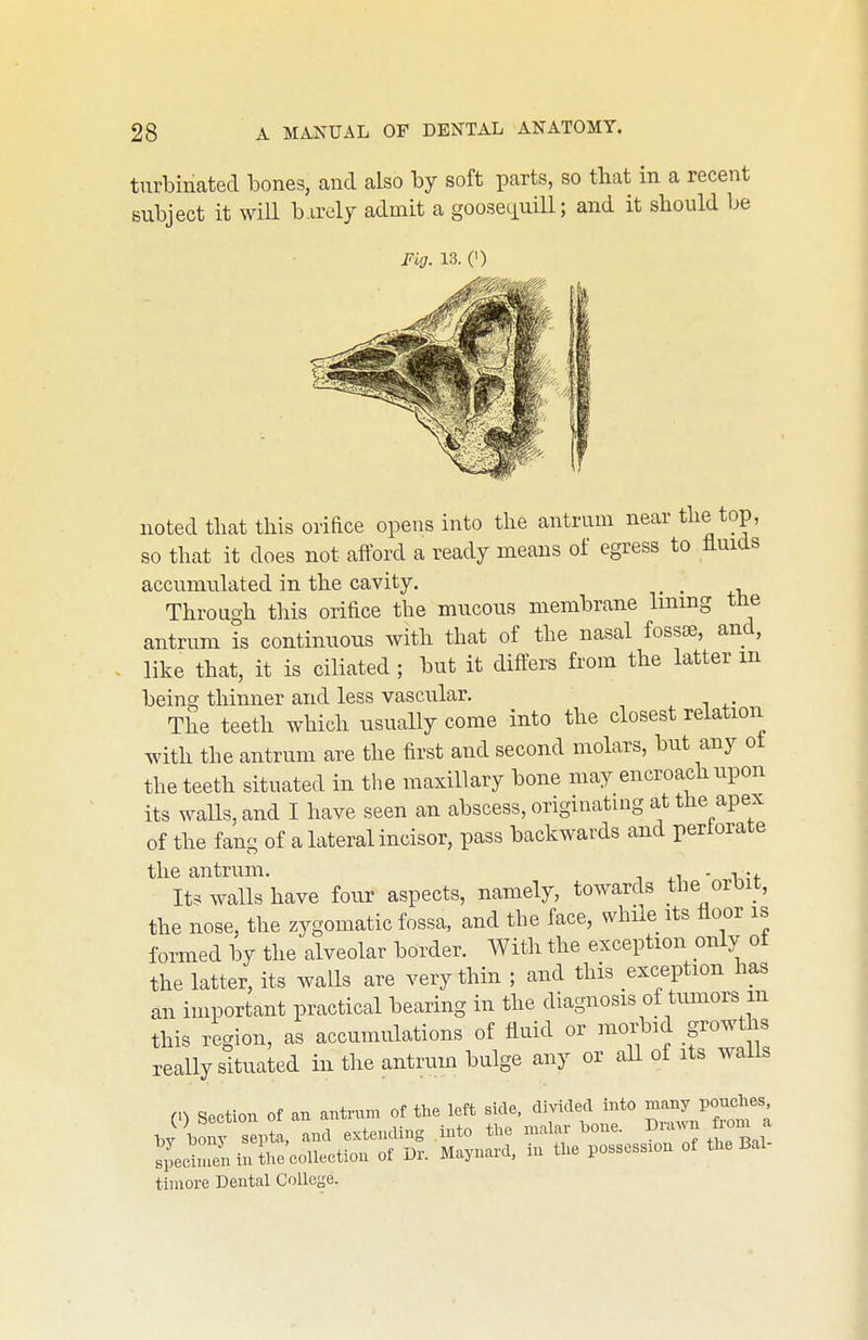 turbinated bones, and also by soft parts, so that in a recent subject it will barely admit a goosequill; and it should be Fig. 13. (I) noted that this orifice opens into the antrum near the top, so that it does not afford a ready means of egress to fluids accumulated in the cavity. _ , Through this orifice the mucous membrane Immg the antrum is continuous with that of the nasal fossre, and, like that, it is ciliated; but it difters from the latter m being thinner and less vascular. , i , • The teeth which usually come into the closest relation with the antrum are the first and second molars, but any ot the teeth situated in the maxillary bone may encroach upon its walls, and I have seen an abscess, originating at the apex of the fang of a lateral incisor, pass backwards and periorate the antrum. . , It.^ walls have four aspects, namely, towards the orOit, the nose, the zygomatic fossa, and the face, while its floor is formed by the alveolar border. With the exception only ot the latter, its walls are very thin ; and this exception has an important practical bearing in the diagnosis of tumors m this region, as accumulations of fluid or morbid growths really situated in the antrum bulge any or all of its walls rn Section of an antrum of the left side, divided into many pouches Jbon s pta. and extending into the malar bone. Drawn from a specimen in ?he collection of Dr. Maynard, in the possession of the Bal tiniore Dental College.