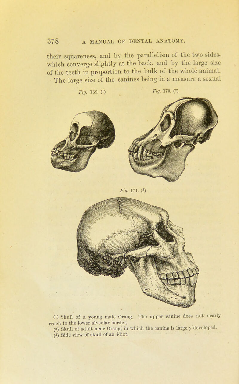 their squareness, and by the parallelism of the two sides, which converge slightly at the back, and by the large size of the teeth in proportion to the bulk of the whole animal. The laro-e size of the canines being in a measure a sexual Fig. 169. (1) 170. («) Q) Skiill of a young male Orang. The upper canine does not nearly reach to the lower alveolar border. (2) Skull of adult male Orang, in wliich the canine is largely developeiU (3) Side view of skull of an idiot.