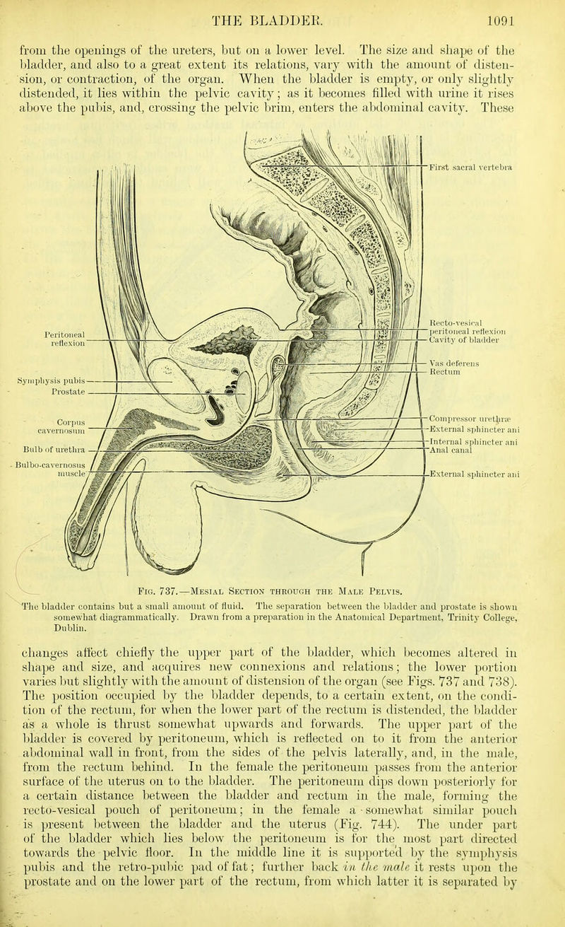 from the openings of the ureters, but on a lower level. The size and shape of the bladder, and also to a great extent its relations, vary with the amount of disten- sion, or contraction, of tlie organ. When the bladder is empty, or only slightly distended, it lies within the pelvic cavity; as it becomes filled with urine it rises above the pubis, and, crossing the pelvic l)rim, enters the alxlominal cavity. These Fig. 737.—Mesial Section through the Male Pelvis. Tilt! bladder contaiuti but a small amount of tiuid. The seiiaration between the bladder and prostate is shown somewhat diagrammatioally. Drawn from a preparation in the Anatomical Department, Trinity College, Dnblin. changes affect chieily the upper part of the liladder, which Ijecomes altered in shape and size, and acquires new connexions and relations; the lower portion varies ljut slightly with the amount of distension of the organ (see Figs. 737 and 738). The position occupied by the bladder depends, to a certain extent, on the condi- tion of the rectum, for when the lower part of the rectum is distended, the bladder as a whole is thrust somewhat upwards and forwards. The upper part of the bladder is covered by peritoneum, which is refiected on to it from the anterior al)dominal wall in front, from the sides of the pelvis laterally, and, in the male, from the rectum behind. In the female the peritoneum passes from the anterior surface of the uterus on to the bladder. The peritoneum dips down posteriorly for a certain distance between the bladder and rectum in the male, forming the recto-vesical pouch of peritoneum; in the female a ■ somewhat similar pouch is present ))etween the bladder and the uterus (Fig. 744). The under part of the bladder which lies below the peritoneum is for the most part directed towards the pelvic Moor. In the middle line it is supporte'd by the symphysis pubis and the retro-pubic pad of fat; further back in the male it rests upon the prostate and on the lower part of the rectum, from which latter it is separated by