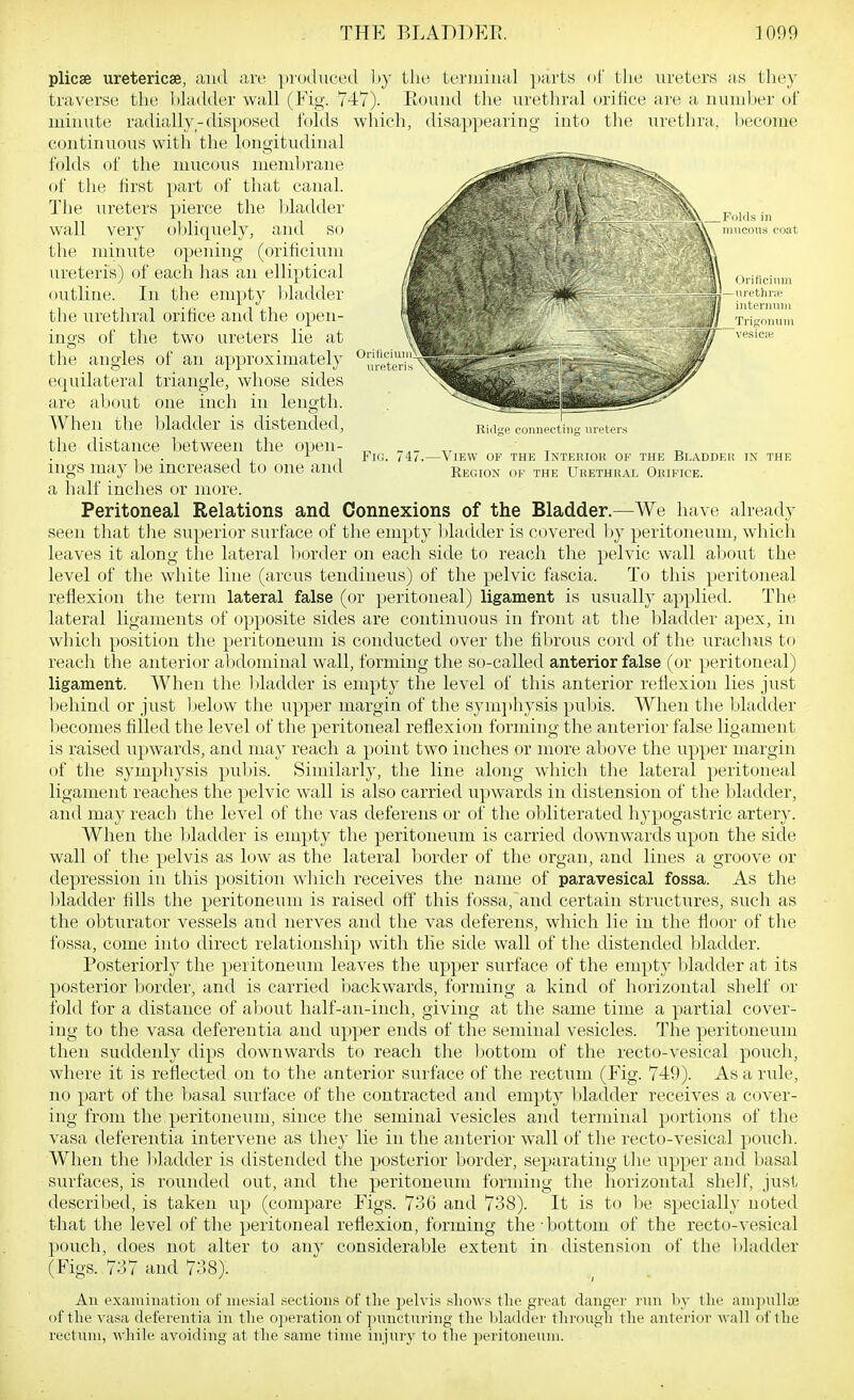 plicae uretericse traverse! the lil minute radially and are ])r()dueed l)y ulder wall (Fiy. 747). lisposed Inlds wliich, disappearing into the urethra, l)ecome the terminal parts of tlie ureters as they Eound the urethral oritice are a numljer of continuous with the longitudinal folds of the of the first The ureters wall very the miniite mucous memhrane part of that canal, pierce the 1 tiadder oliliquely, and so opening (orificiuni ureteris) of each has an elliptical outline. In the empty 1 (ladder the urethral orifice and the open- ings of the two ureters lie at the angles of an approximately equilateral triangle, wiiose sides are about one inch in length. When the bladder is distended, the distance between the open- ings may be increased to one and a half inches or more. Peritoneal Relations and Connexions seen that the superior surface of the empty coat Ridge coiiiifctiiig ureters Fl(!. 747. View of THE INTERIOU of THE Bl.ADDEH IN THE OF THE UhETHRAL ORIFICE. of the Bladder.—We have already ladder is covered by peritoneum, which leaves it along the lateral border on each side to reacih the pelvic wall about the level of the white line (arcus tendineus) of the pelvic fascia. To this peritoneal reflexion the term lateral false (or peritoneal) ligament is usually ap])lied. The lateral ligaments of o})posite sides are continuous in front at the bladder apex, in which position the peritoneum is conducted over the fibrous cord of the urachus to reach the anterior abdominal wall, forming the so-called anterior false (or peritoneal) ligament. When the bladder is empty the level of this anterior reflexion lies just behind or just l)elow the upper margin of the symjihysis pubis. When the bladder becomes filled the level of the peritoneal reflexion forming the anterior false ligament is raised upwards, and may reach a point two inches or more above the upper margin of the symphysis pubis. Similarly, the line along which the lateral peritoneal ligament reaches the pelvic wall is also carried upwards in distension of the bladder, and may reach the level of the vas deferens or of the obliterated hypogastric artery. When the bladder is empty the peritoneum is carried downwards upon the side wall of the pelvis as low as the lateral border of the organ, and lines a groove or depression in this position which receives the name of paravesical fossa. As the bladder fills the peritoneum is raised off this fossa, and certain structures, such as the obturator vessels and nerves and the vas deferens, which lie iu the floor of the fossa, come into direct relationship with the side wall of the distended bladder. Posteriorly the peritoneum leaves the upper surface of the empty l)ladder at its posterior l:)order, and is carried backwards, forming a kind of horizontal shelf or fold for a distance of about half-an-inch, giving at the same time a partial cover- ing to the vasa deferentia and upper ends of the seminal vesicles. The peritoneum then suddenly dips downwards to reach the bottom of the recto-vesical pouch, where it is reflected on to the anterior surface of the rectum (Fig. 749). As a rule, no part of the l)asal surface of the contracted and empty Itladder receives a cover- ing from the peritoneum, since tlie seminal vesicles and terminal portions of the vasa deferentia intervene as they lie in the anterior wall of the recto-vesical pouch. When the bladder is distended the posterior border, separating tlie upper and basal surfaces, is rounded out, and the peritoneum forming the horizontal shelf, just described, is taken up (compare Figs. '36 and 738). It is to be specially noted that the level of the peritoneal reflexion, forming the •bottom of the recto-vesical pouch, does not alter to any considerable extent in distension of the 1 (ladder (Figs. 737 and 738). An exaniiiiation of mesial section!? of tlie pelvis shows the great danger run by the ampnlla3 of the vasa deferentia in the operation of jiunctnring the bladder through the anterior wall of the rectum, while avoiding at the same time injury to the peritoneum.