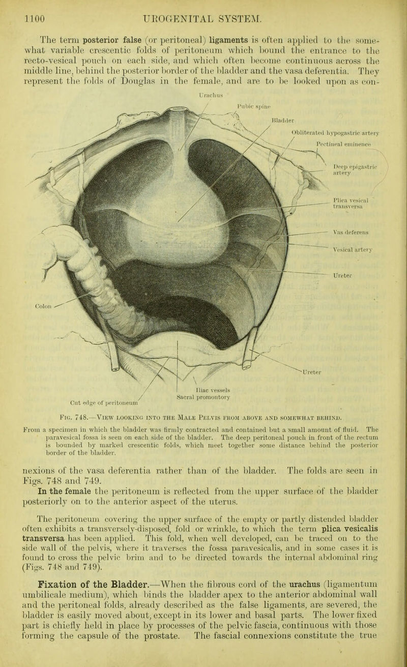 The term posterior false (or peritoneal) ligaments is often applied to the some- what variable crescentic folds of peritoneum which bound the entrance to the recto-vesical pouch on each side, and which often l)ecome continuous across the middle line, behind the posterior l )order of the bladder and the vasa deferentia. They represent the folds of Douglas in the female, and are to be looked upon as eon- Uracliiis Vh:. 748.—View lookin(; into the Male Pelvis from above and somewhat behin.u. Kiom a specimen in which the bladder was firmly coutracteil and contained but a small amount of fluid. The paravesical fossa is .seen on each side of the bladder. The deep peritoneal poucli in front of the rectum is bounded by marked crescentic fohls, which meet together some distance behind the posterioi- border of the bladder. nexions of the vasa deferentia rather than of the bladder. Tlie folds are seen in Figs. 748 and 749. In the female the peritoneum is reflected from tho. upper surface of the );)lHdder posteriorly on to the anterior aspect of the uterus. The peritoneum covering the upper surface of the empty or partly distended bladder often exhibits a transversely-disposed, fold or wrinkle, to which the term plica vesicalis transversa has been applied. This fold, when well developed, can be traced on to the side wall of the pelvis, whei'e it traverses the fossa pai'avesicalis, and in some cases it is found to cross the pelvic brim and to be dii-ected towards the internal alidominal ring (Figs. 748 and 749). Fixation of the Bladder.—When the fibrous cord of the urachus (ligamentum umbilicale medium), which binds the bladder apex to the anterior abdominal wall and the peritoneal folds, already described as the false ligaments, are severed, the bladder is easily moved about, except in its lower and basal parts. The lower fixed part is chiefly held in place by processes of the pelvic fascia, continuous with those forming the ca.psule of the prostate. The fascial connexions constitute the true