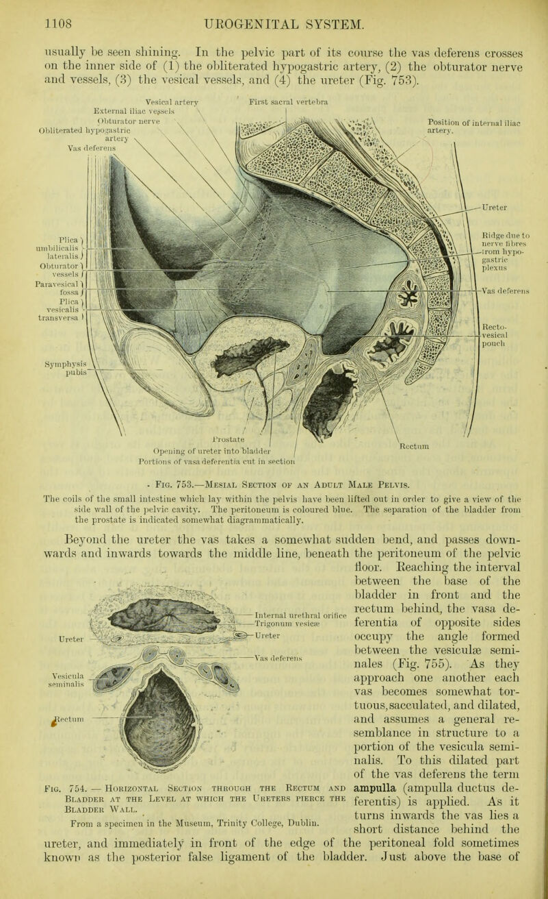 usually be seen shining. In the pelvic part of its c(nirse the vas deferens crosses on the inner side of (1) the obliterated liypogastric artery, (2) the obturator nerve and vessels, (3) the vesical vessels, and (4) the ureter (Fig. 753). Vpfiical artery E.xtHrnal iliac vejist Is > (>Iitunitor nervi; Oliliti'rateil liyi)o.;a.strio artery Vas <leferniis First sacial verti'lira Position of intpviial iliac arterv. J-'rostate Opening of ureter into bladder Portions of vasadeferentia cMit in section Rectum Uretei' Vesicnla . 'SV seminalis ^^^ lectnni Internal nrelhral orilice Trigoimni vesicie Ureter Vas deferen; - Fig. 753.—Mesial Section of an Addlt Male Pelvis. The coils of tlie small intestine wliicli lay within the jielvis liaye been lifted ont in order to give a view of the side \vall of tlie jielvic cavit). The ])eritonenra is coloured bine. The separation of the bladder from the prostate is indicated somewhat diagraniniatically. Beyond the ureter the vas takes a somewhat sudden l^end, and passes down- wards and inwards towards tlie middle line, l)eneath the peritoneum of the pelvic floor. Reaching the interval between the base of the bladder in front and the rectum behind, the vasa de- ferentia of opposite sides occupy the angle formed between the vesiculge semi- nales (Fig. 755). As they approach one another each vas becomes somewhat tor- tuous, sacculated, and dilated, and assumes a general re- semblance in strv;cture to a portion of the vesicula semi- nalis. To this dilated part of the vas deferens the term Fig. 754. — Horizontal Skctidn through the Rectum and ampulla (ampulla ductuS de- Bladder at the Level at which the Ureters pierce the fy^-entis) is applied As it Bladder Wall. , • ' j M-i t turns inwards the vas lies a From a specimen in the Museum, Trinity College, Dubbn. ^j^^^.^ distance behind the ureter, and immediately in front of the edge of the peritoneal fold sometimes known as tlie posterior false ligament of the bladder. Just above the base of