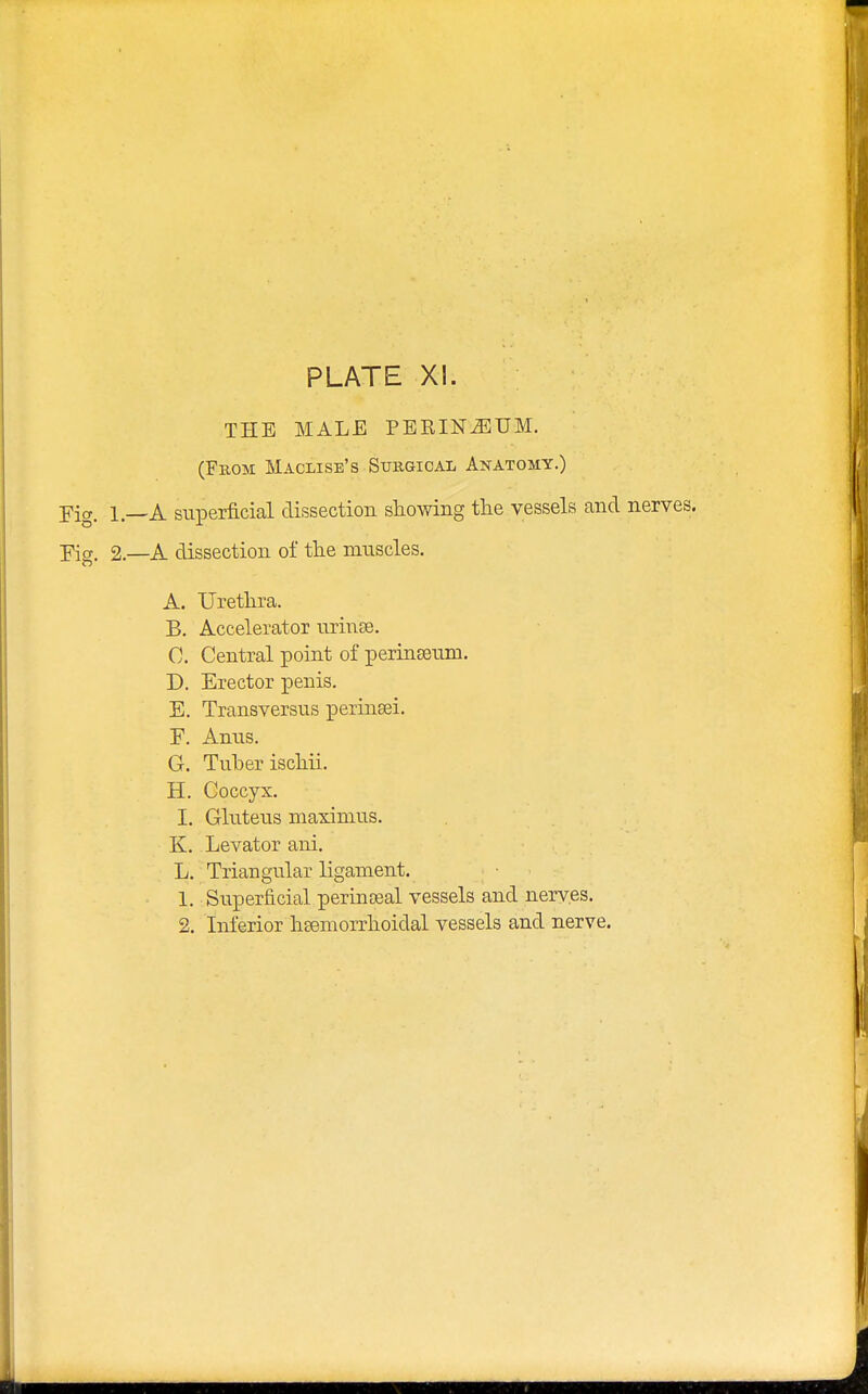 THE MALE PEKIN^TJM. (From Maclise's Surgical Anatomy.) Fig. 1—A superficial dissection snowing the vessels and nerves. Fig. 2—A dissection of the muscles. A. Urethra. B. Accelerator urinoe. 0. Central point of perinseum. D. Erector penis. E. Transversus perinsei. F. Anns. G. Tuber ischii. H. Coccyx. I. Gluteus niaxinius. K. Levator ani. L. Triangular ligament. 1. Superficial perineal vessels and nerves. 2. Inferior hsemorrhoidal vessels and nerve.
