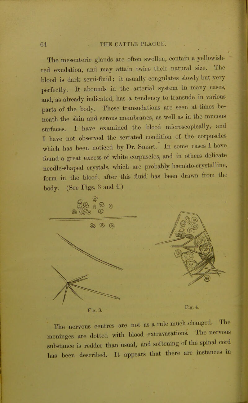 The mesenteric glands are often swollen, contain a yellowish- red exudation, and may attain twice their natural size. The blood is dark semi-fluid; it usually congulates slowly but very perfectly. It abounds in the arterial system in many cases, and, as already indicated, has a tendency to transude in various parts of -the body. These transudations are seen at times be- neath the skin and serous membranes, as well as in the mucous surfaces. I have examined the blood microscopically, and I have not observed the serrated condition of the cori5uscles which has been noticed by Dr. Smart. In some cases I have found a great excess of white corpuscles, and in others delicate needle-shaped crystals, which are probably hsemato-crystalline, form in the blood, after this fluid has been drawn from the body. (See Figs. 3 and 4.) <s> ® Fig. 3. Fig. 4. The nervous centres are not as a rule much changed. The meninges are dotted with blood extravasations. The nervous substance is redder than usual, and softening of the spinal cord has been described. It appears that there are instances in