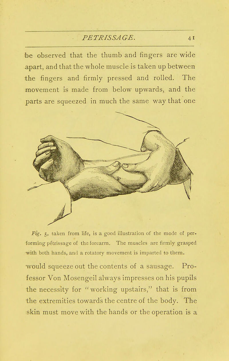 be observed that the thumb and fingers are wide apart, and that the whole muscle is taken up between the fingers and firmly pressed and rolled. The movement is made from below upwards, and the parts are squeezed in much the same way that one Fig. 5, taken from life, is a good illustration of the mode of per- forming petrissage of the forearm. The muscles are firmly grasped with both hands, and a rotatory movement is imparted to them. would squeeze out the contents of a sausage. Pro- fessor Von Mosengeil always impresses on his pupils the necessity for working upstairs, that is from the extremities towards the centre of the body. The skin must move with the hands or the operation is a