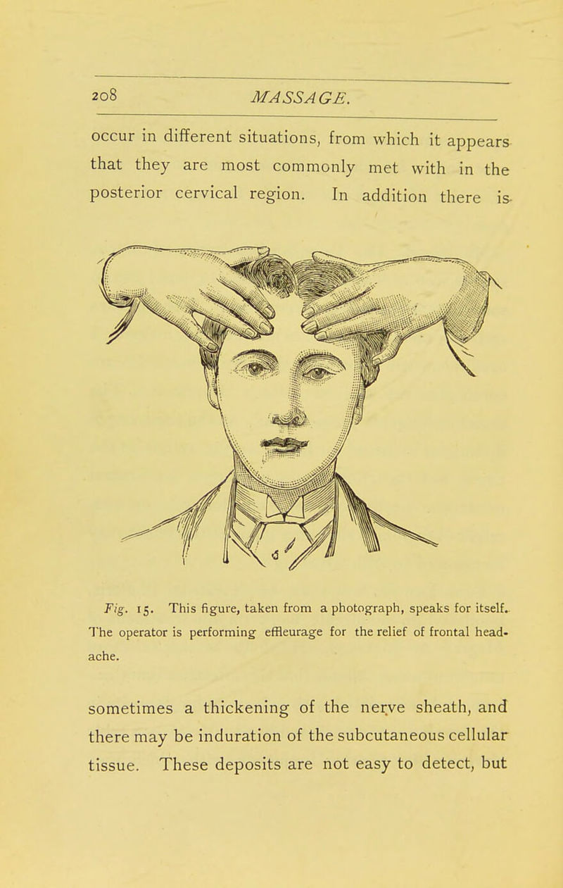 occur in different situations, from which it appears that they are most commonly met with in the posterior cervical region. In addition there is- Fig. 15. This figure, taken from a photograph, speaks for itself. The operator is performing efHeurage for the relief of frontal head- ache. sometimes a thickening of the nerve sheath, and there may be induration of the subcutaneous cellular tissue. These deposits are not easy to detect, but