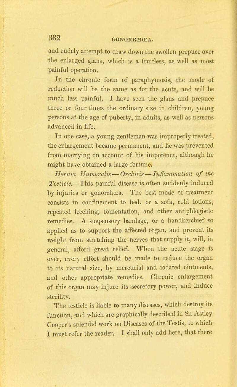 and rudely attempt to draw down the swollen prepuce over the enlarged glans, which is a fruitless, as well as most painful operation. In the chronic form of paraphymosis, the mode of reduction will he the same as for the acute, and will be much less painful. I have seen the glans and prepuce three or four times the ordinary size in children, young persons at the age of puberty, in adults, as well as persons advanced in life. In one case, a young gentleman was improperly treated, the enlargement became permanent, and he was prevented from marrying on account of his impotence, although he might have obtained a large fortune. Hernia Humoralis—Orchitis—Inflammation of the Testicle.—This painful disease is often suddenly induced by injuries or gonorrhoea. The best mode of treatment consists in confinement to bed, or a sofa, cold lotions, repeated leeching, fomentation, and other antiphlogistic remedies. A suspensory bandage, or a handkerchief so applied as to support the aflfected organ, and prevent its weight from stretching the nerves that supply it, will, in general, afford great reUef. When the acute stage is over, every effort should be made to reduce the organ to its natural size, by mercurial and iodated ointments, and other appropriate remedies. Chronic enlargement of this organ may injure its secretory power, and induce sterility. The testicle is liable to many diseases, which destroy its function, and which are graphically described in Sir Astley Cooper's splendid work on Diseases of the Testis, to which I must refer the reader. 1 shall only add here, that there