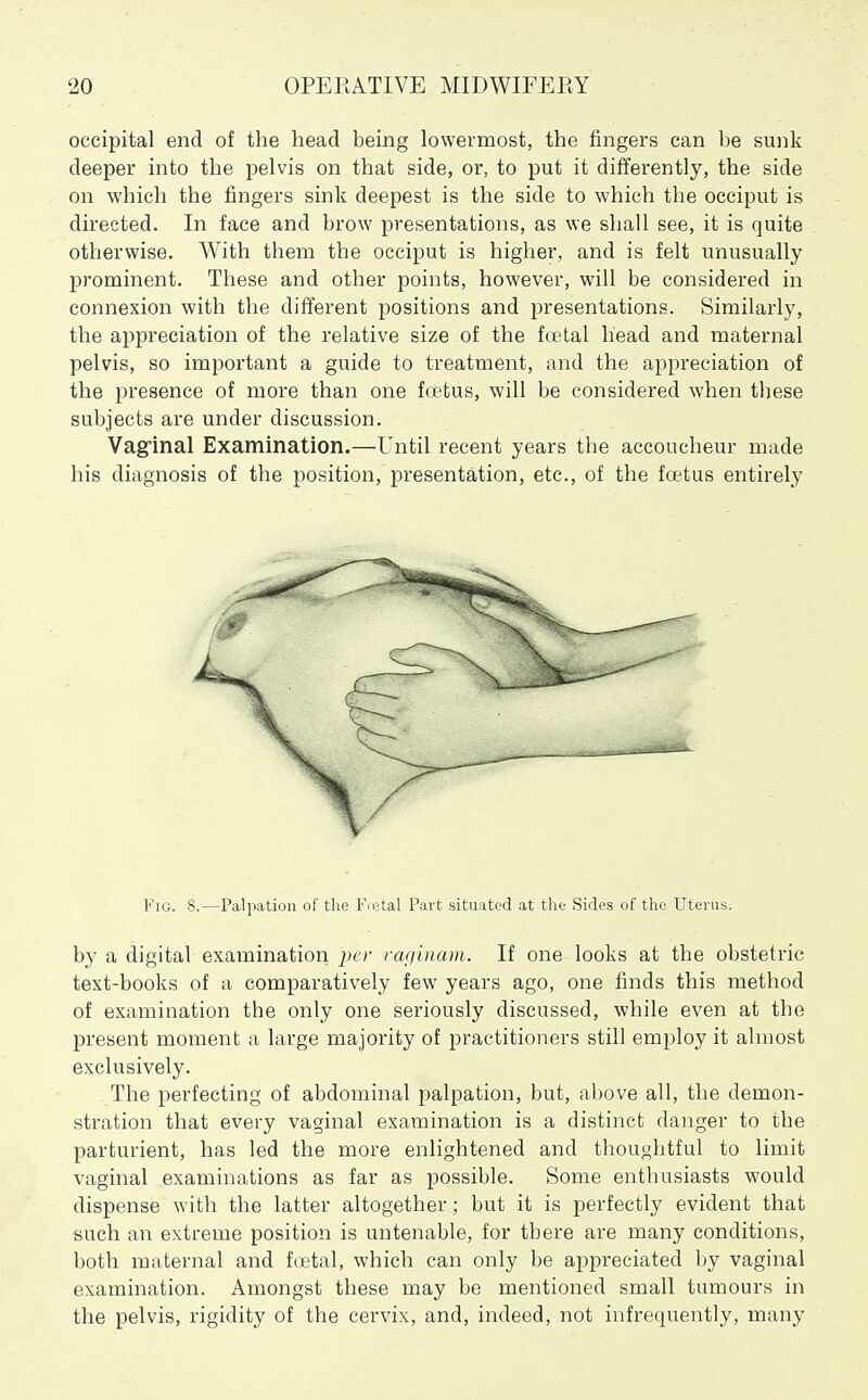 occipital end of the head being lowermost, the fingers can be sunk deeper into the pelvis on that side, or, to put it differently, the side on which the fingers sink deepest is the side to which the occiput is directed. In face and brow presentations, as we shall see, it is quite otherwise. With them the occiput is higher, and is felt unusually pi'ominent. These and other points, however, will be considered in connexion with the different positions and presentations. Similarly, the appreciation of the relative size of the fuetal head and maternal pelvis, so important a guide to treatment, and the appreciation of the presence of more than one fcetus, will be considered when these subjects are under discussion. Vaginal Examination.—Until recent years the accoucheur made his diagnosis of the position, presentation, etc., of the foetus entirely Fig. 8.—Palpation of the F.etal Part situated at the Sides of the Uterus. by a digital examination 2)c'r ragUiam. If one looks at the obstetric text-books of a comparatively few years ago, one finds this method of examination the only one seriously discussed, while even at the present moment a large majority of practitioners still employ it almost exclusively. The perfecting of abdominal palpation, but, above all, the demon- stration that every vaginal examination is a distinct danger to the parturient, has led the more enlightened and thoughtful to limit vaginal examinations as far as possible. Some enthusiasts would dispense with the latter altogether; but it is perfectly evident that such an extreme position is untenable, for there are many conditions, both maternal and foetal, which can only be appreciated by vaginal examination. Amongst these may be mentioned small tumours in the pelvis, rigidity of the cervix, and, indeed, not infrequently, many